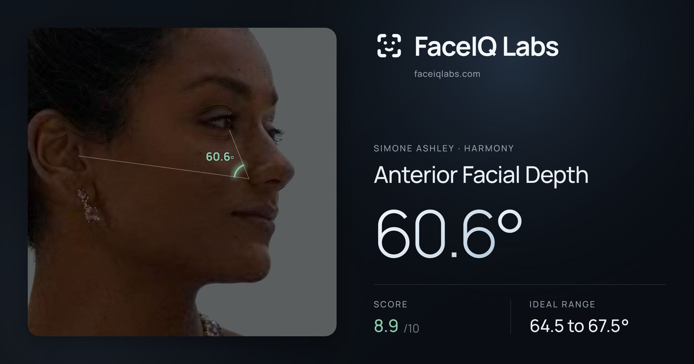 Simone Ashley Anterior Facial Depth: 60.6°, drawn on the photo