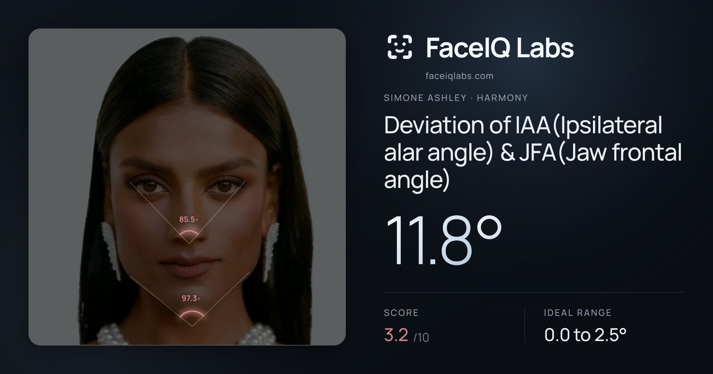 Simone Ashley Deviation of IAA(Ipsilateral alar angle) & JFA(Jaw frontal angle): 11.8°, drawn on the photo