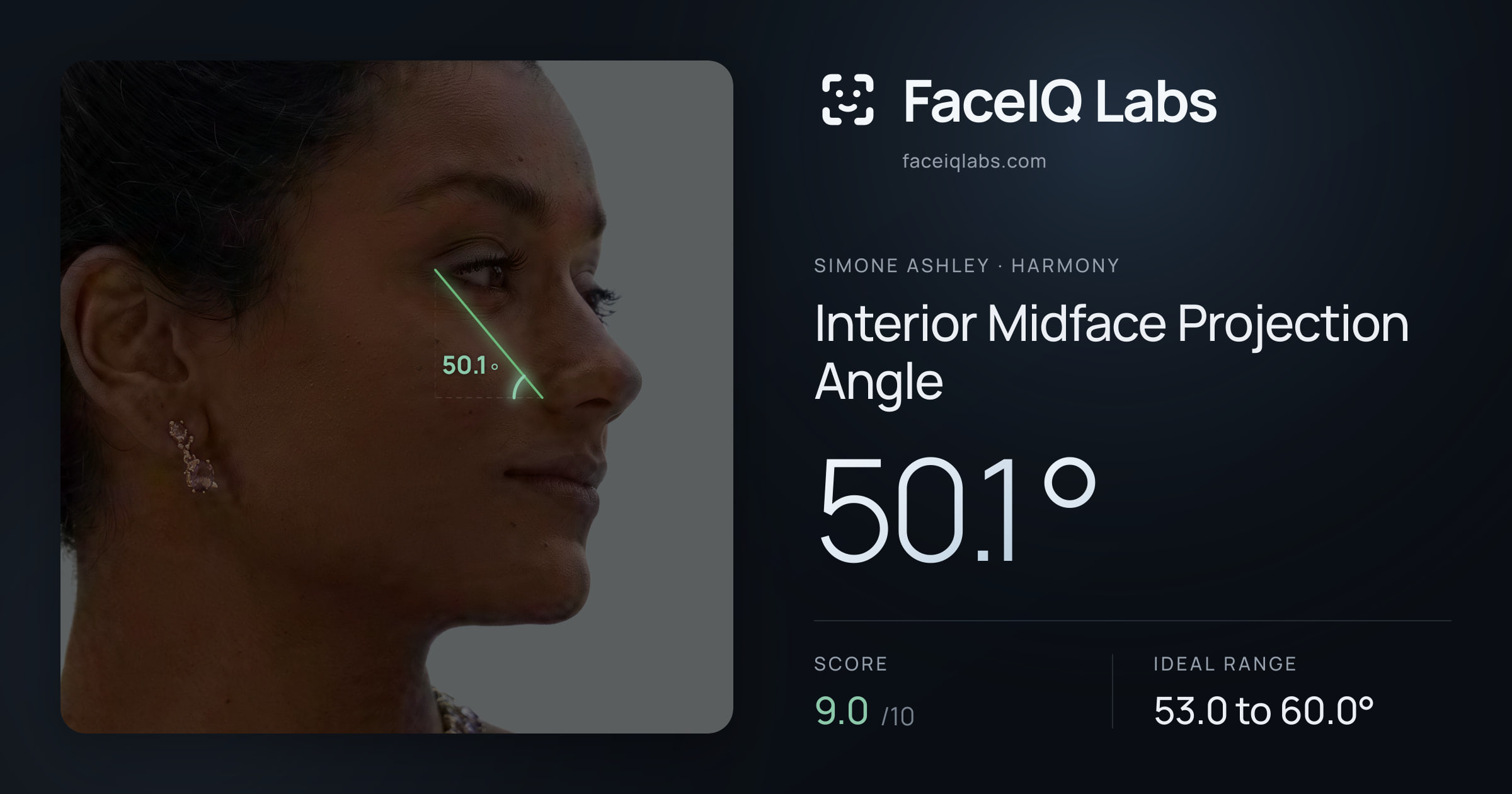 Simone Ashley Interior Midface Projection Angle: 50.1°, drawn on the photo