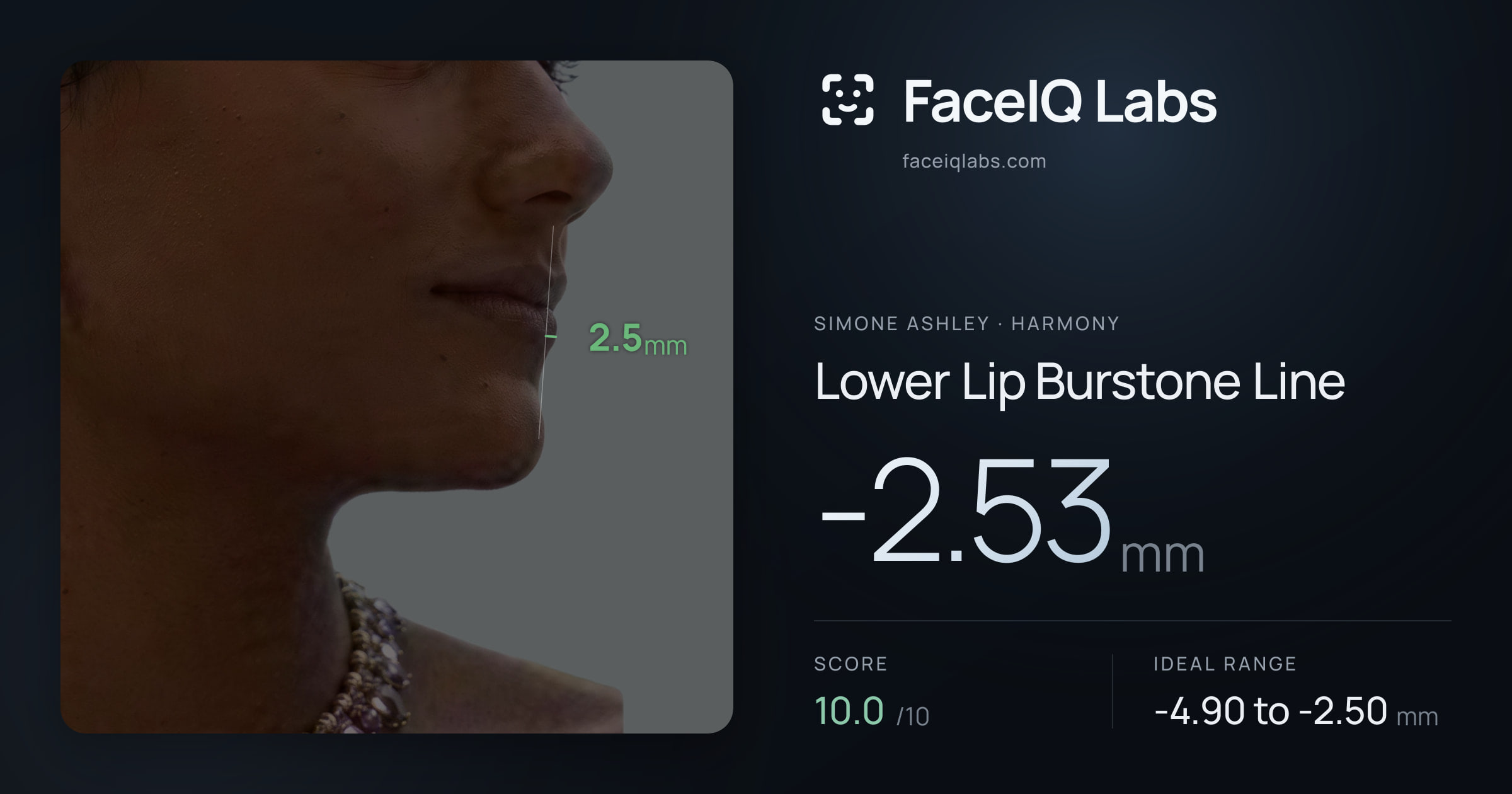 Simone Ashley Lower Lip Burstone Line: -2.53mm, drawn on the photo