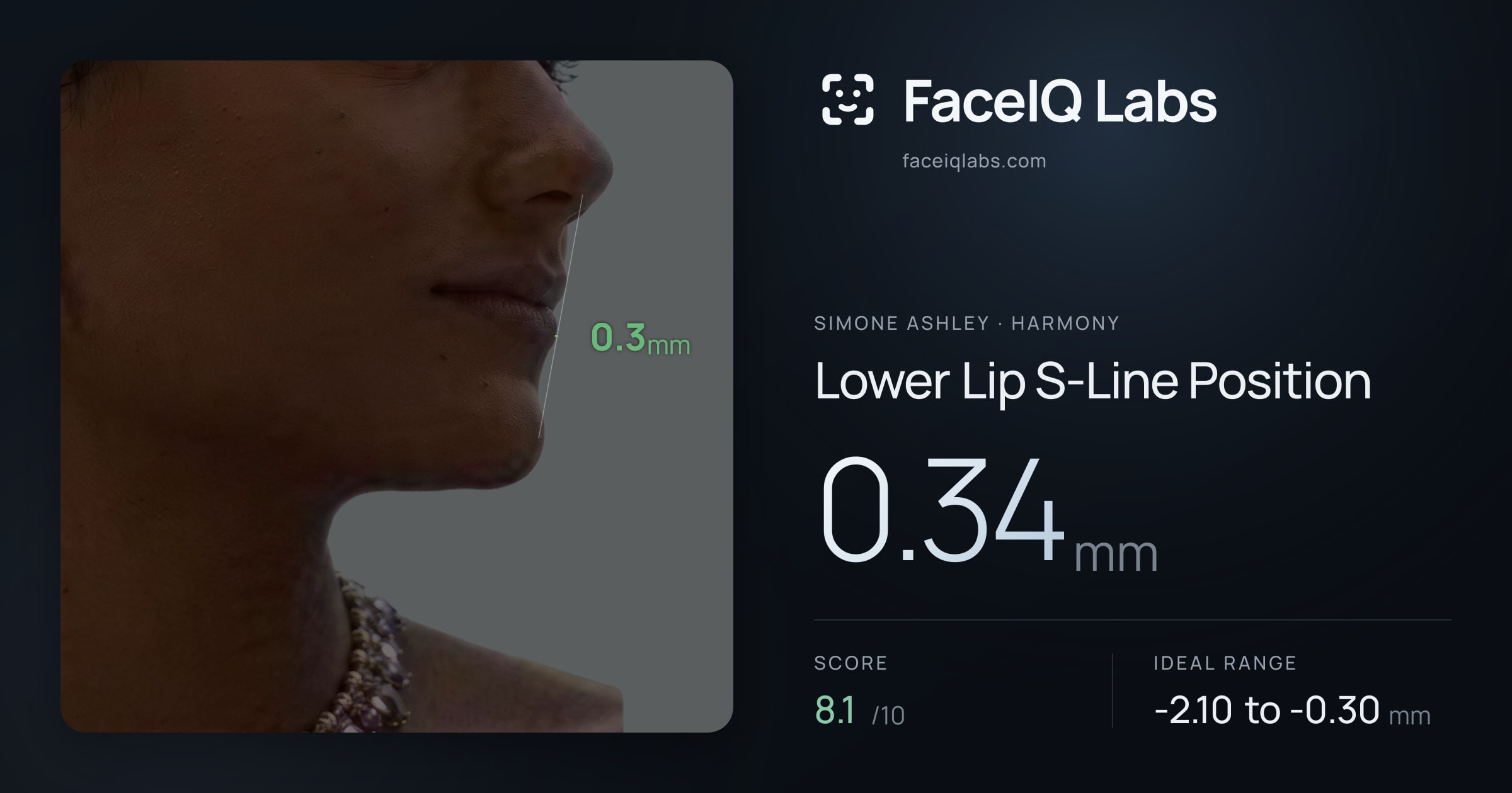 Simone Ashley Lower Lip S-Line Position: 0.34mm, drawn on the photo