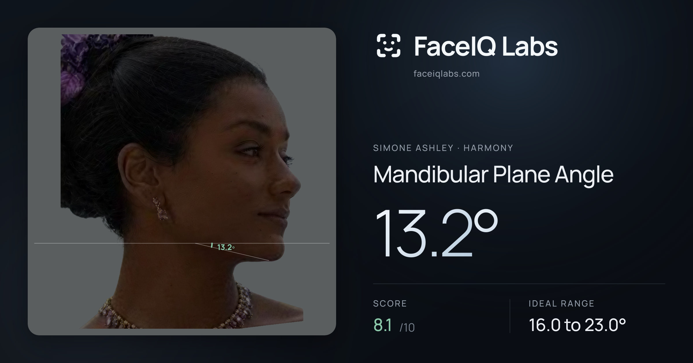 Simone Ashley Mandibular Plane Angle: 13.2°, drawn on the photo