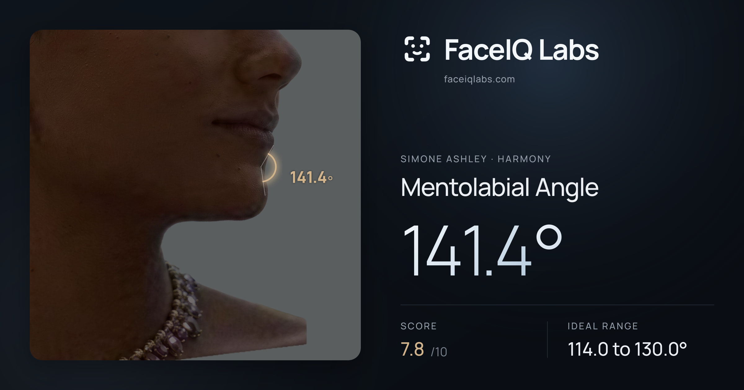 Simone Ashley Mentolabial Angle: 141.4°, drawn on the photo