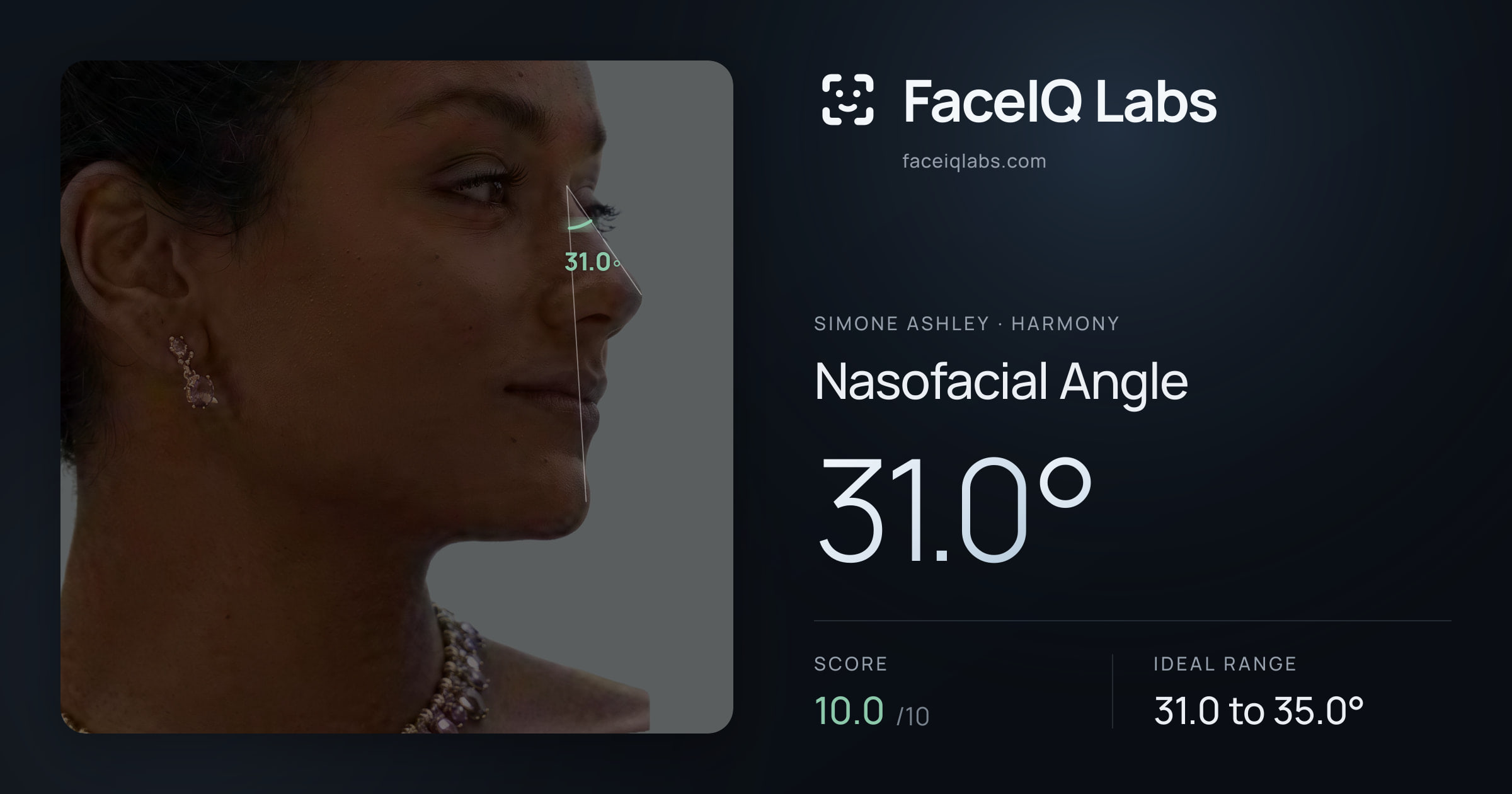 Simone Ashley Nasofacial Angle: 31.0°, drawn on the photo