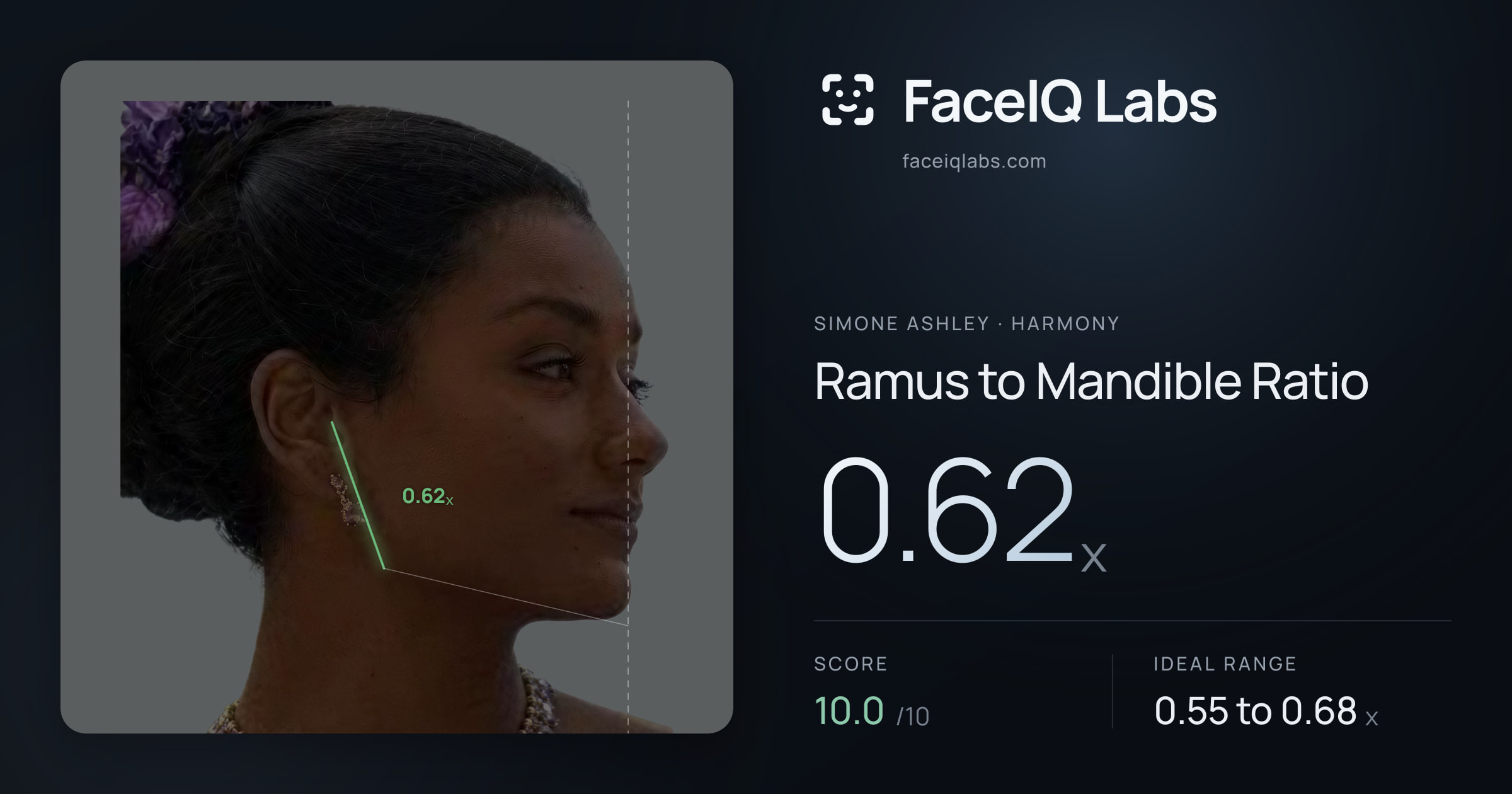 Simone Ashley Ramus to Mandible Ratio: 0.62x, drawn on the photo