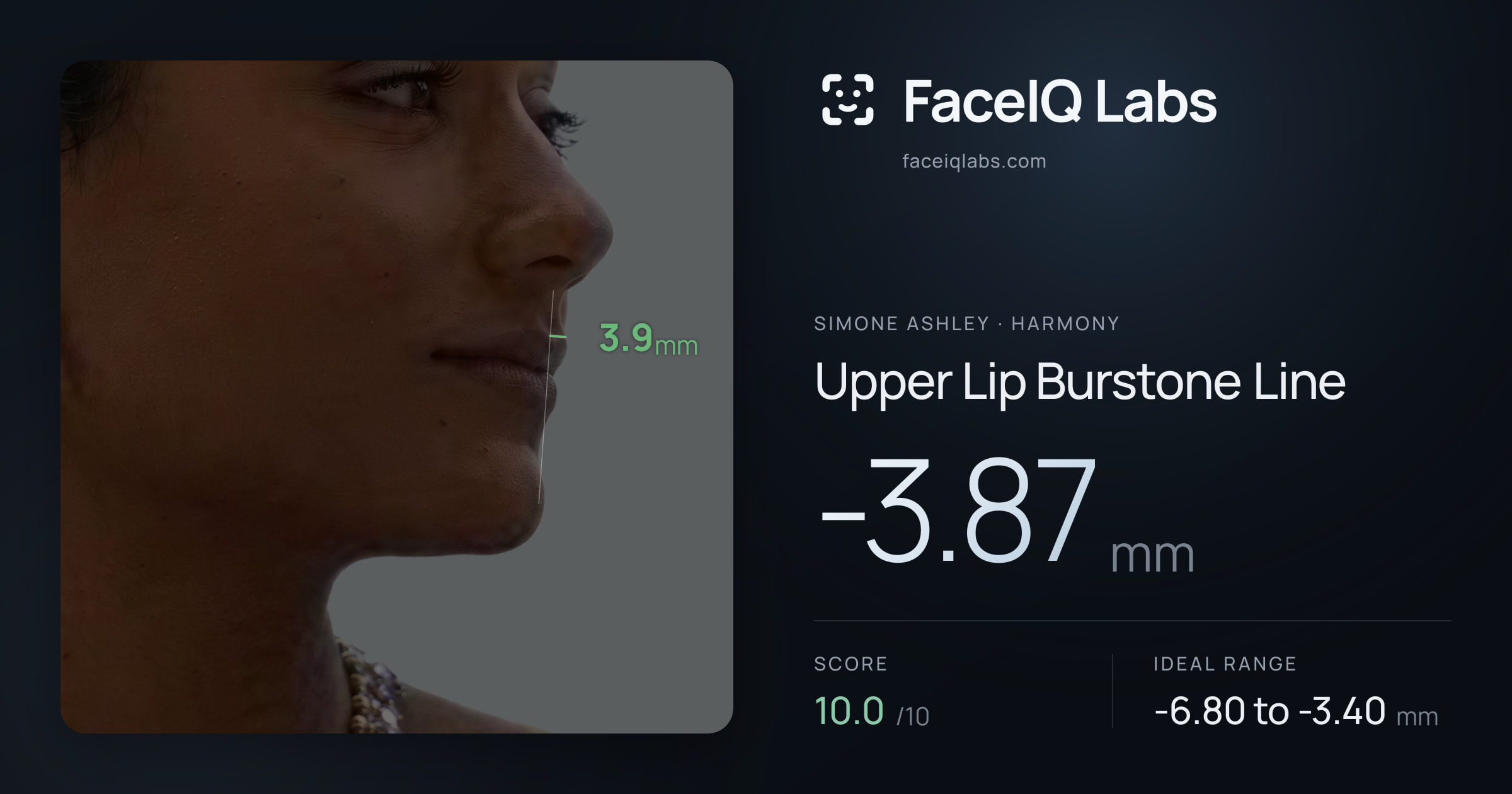 Simone Ashley Upper Lip Burstone Line: -3.87mm, drawn on the photo