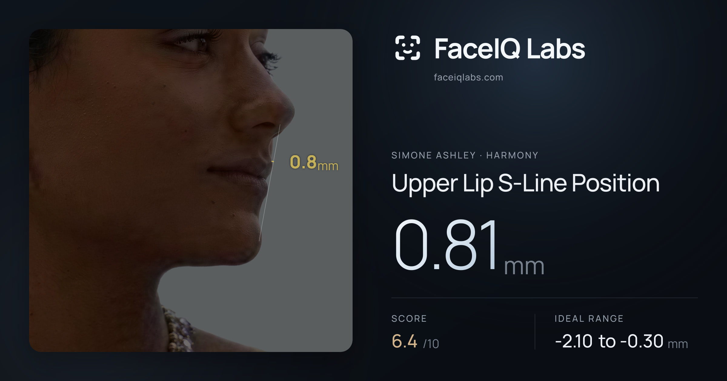 Simone Ashley Upper Lip S-Line Position: 0.81mm, drawn on the photo