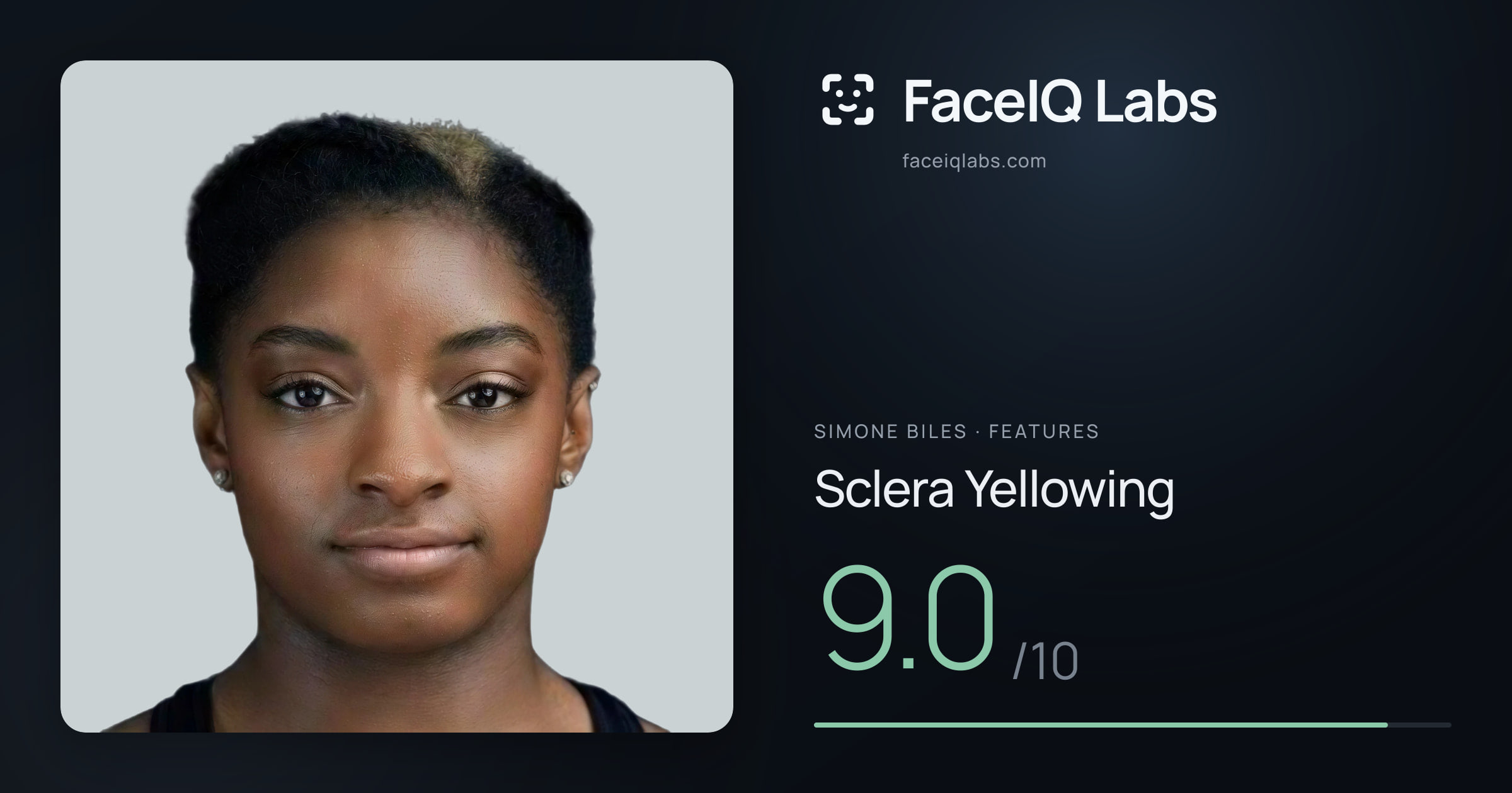 Simone Biles Sclera Yellowing: 9.0/10, drawn on the photo