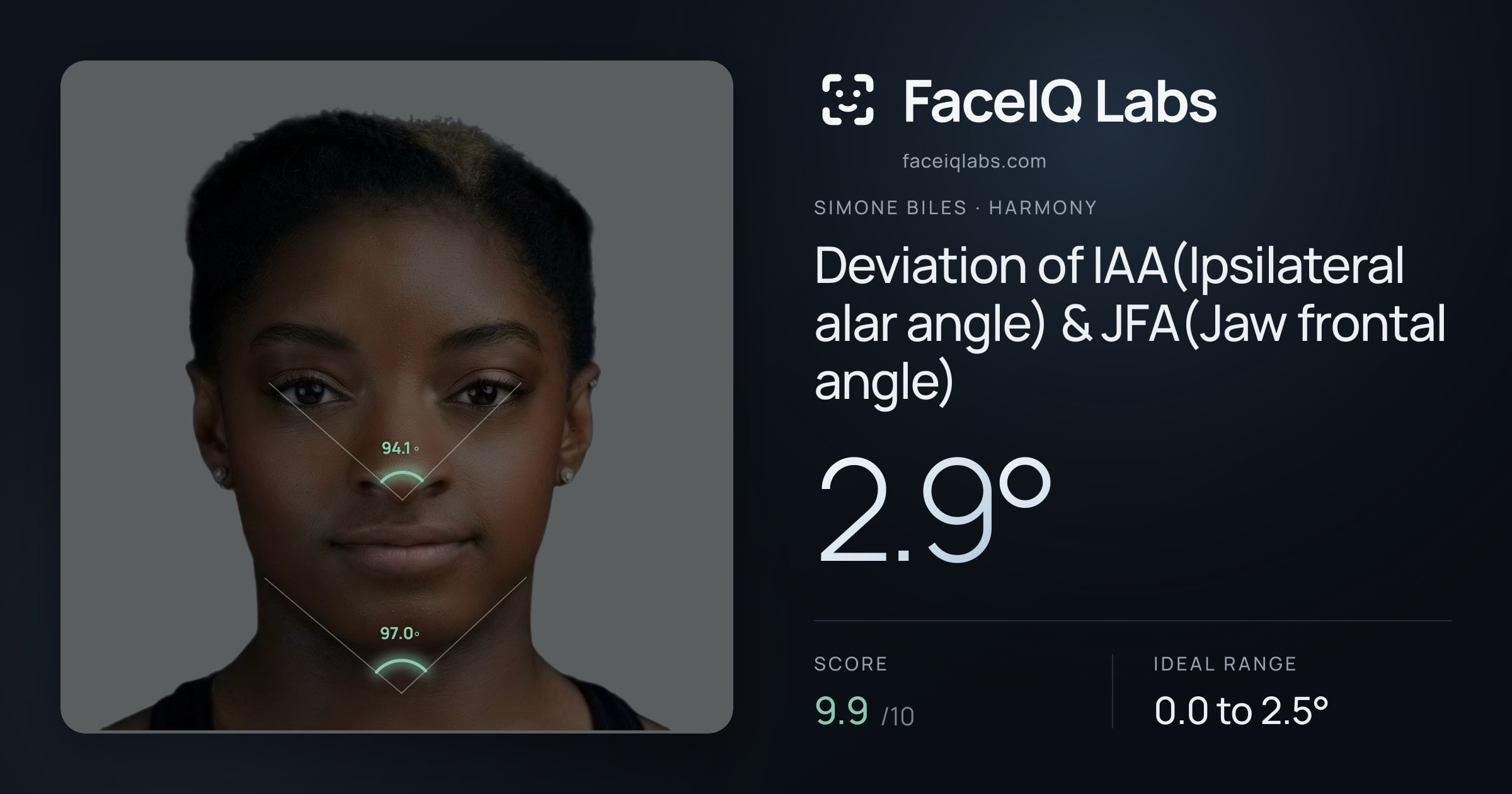 Simone Biles Deviation of IAA(Ipsilateral alar angle) & JFA(Jaw frontal angle): 2.9°, drawn on the photo