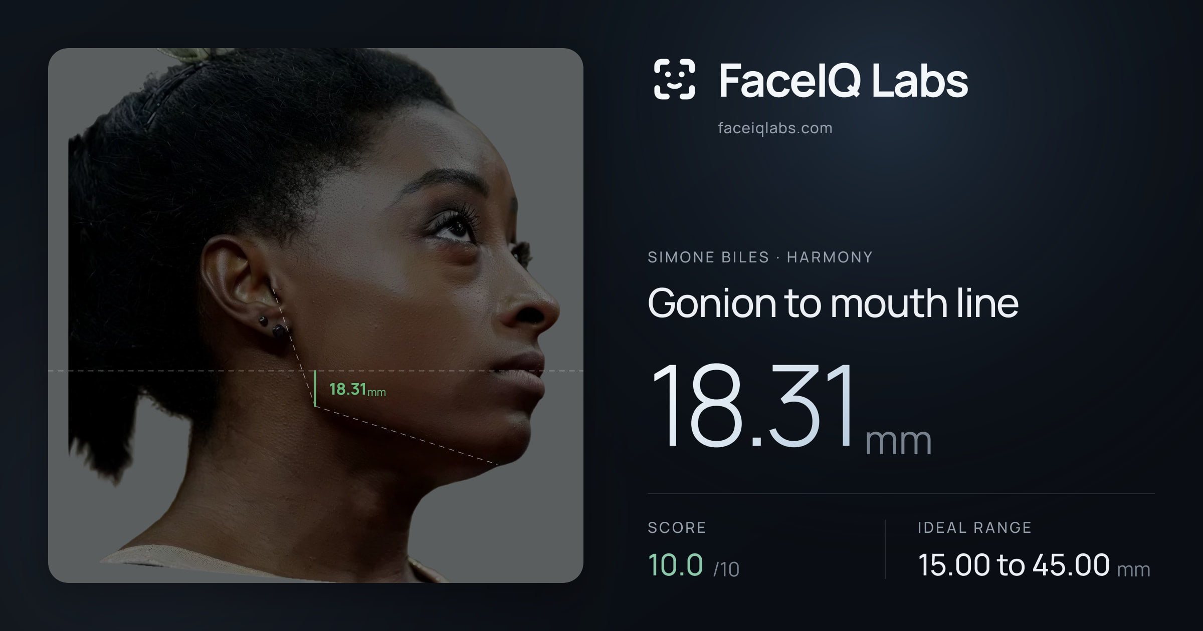 Simone Biles Gonion to mouth line: 18.31mm, drawn on the photo