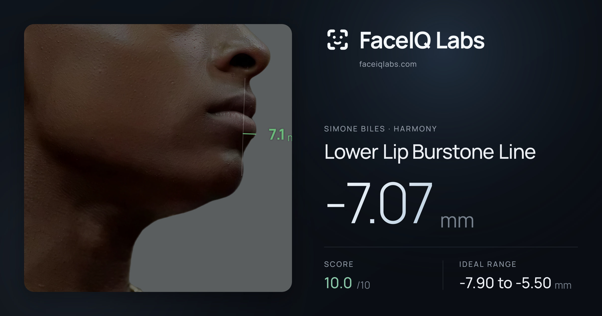 Simone Biles Lower Lip Burstone Line: -7.07mm, drawn on the photo