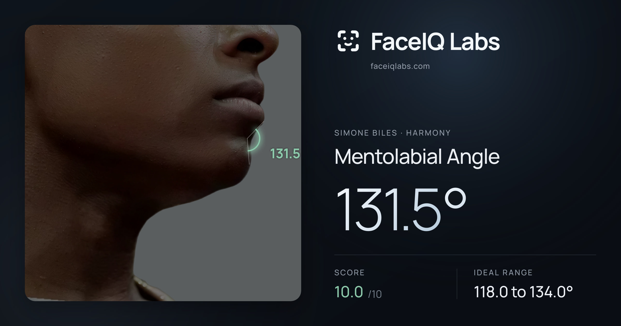 Simone Biles Mentolabial Angle: 131.5°, drawn on the photo