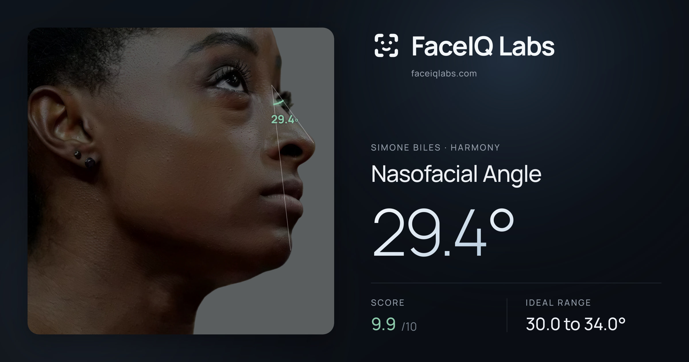 Simone Biles Nasofacial Angle: 29.4°, drawn on the photo