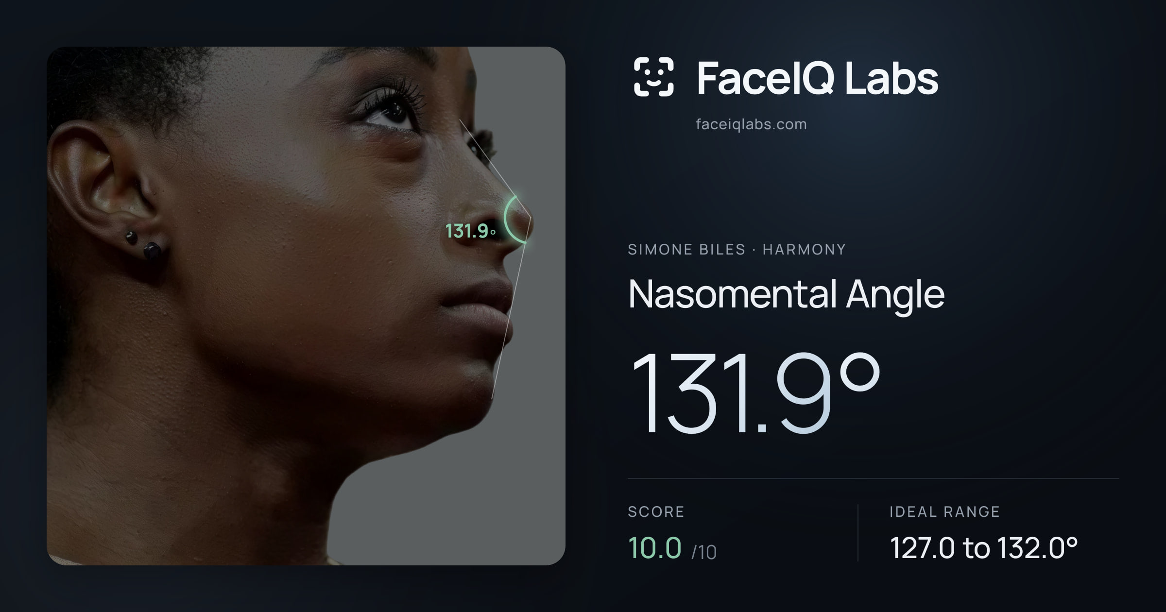Simone Biles Nasomental Angle: 131.9°, drawn on the photo