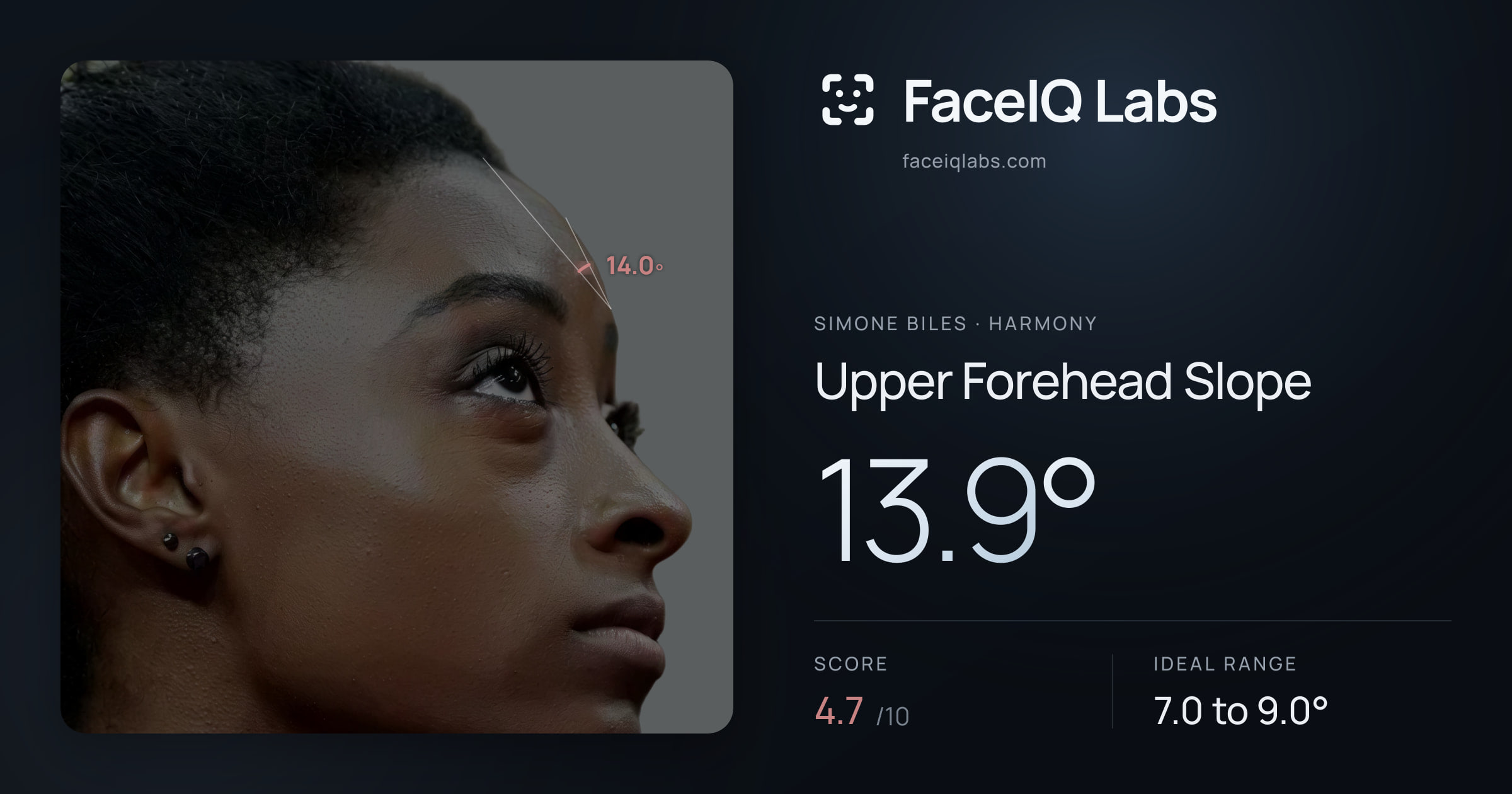 Simone Biles Upper Forehead Slope: 13.9°, drawn on the photo