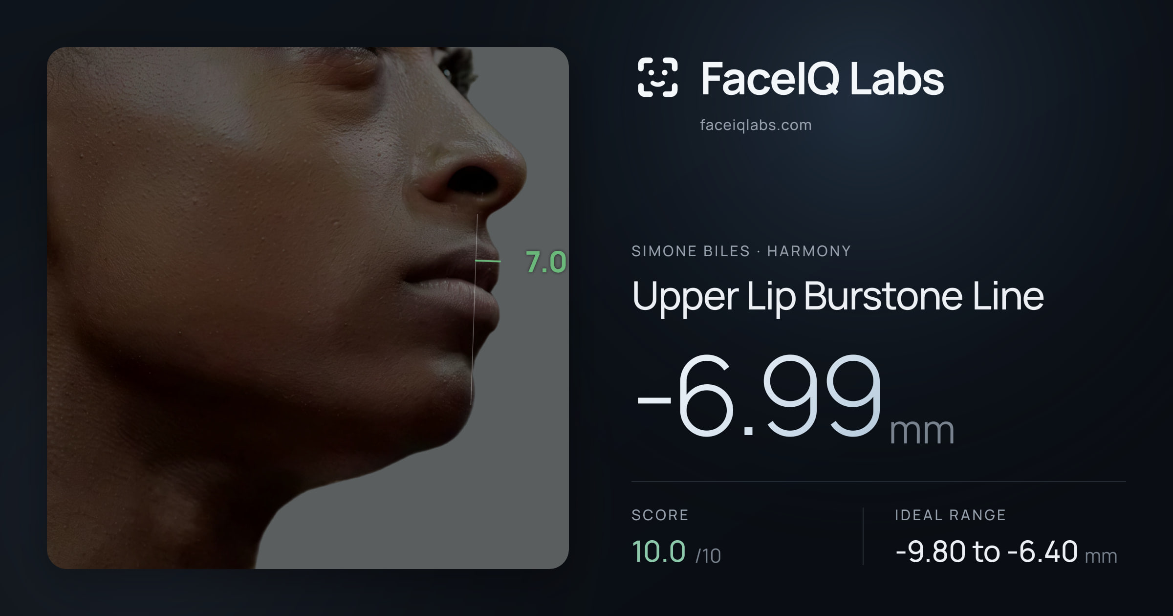 Simone Biles Upper Lip Burstone Line: -6.99mm, drawn on the photo