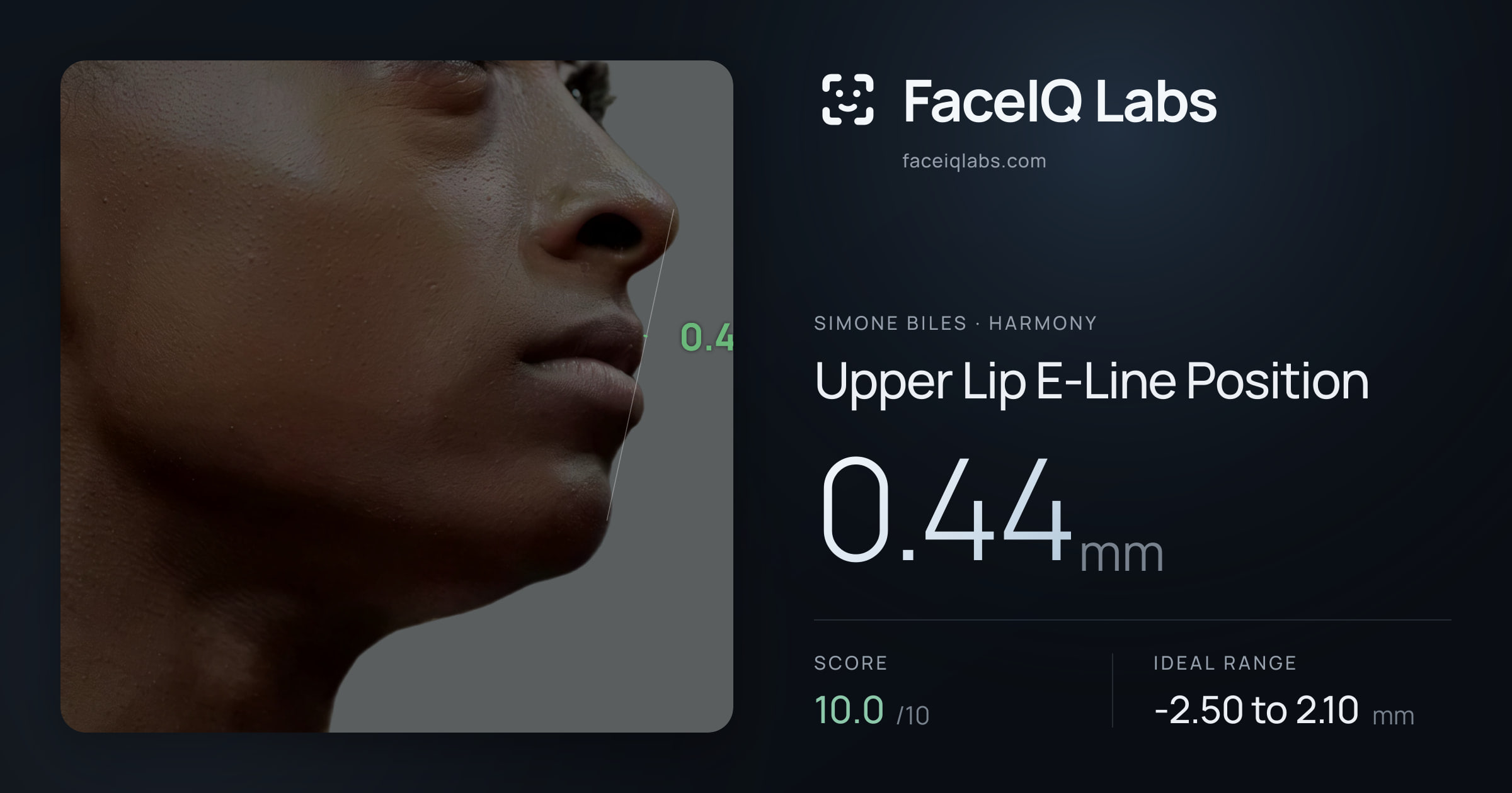 Simone Biles Upper Lip E-Line Position: 0.44mm, drawn on the photo