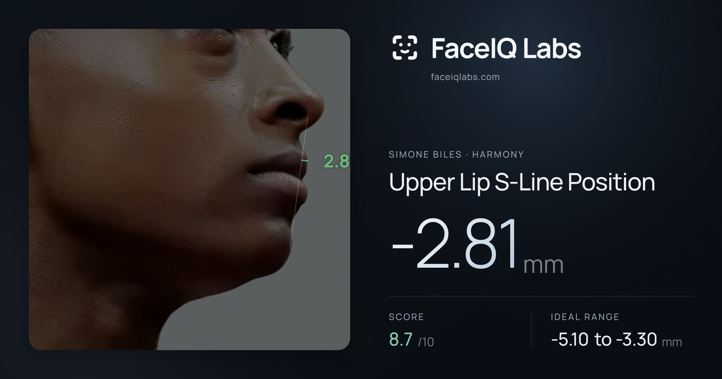 Simone Biles Upper Lip S-Line Position: -2.81mm, drawn on the photo