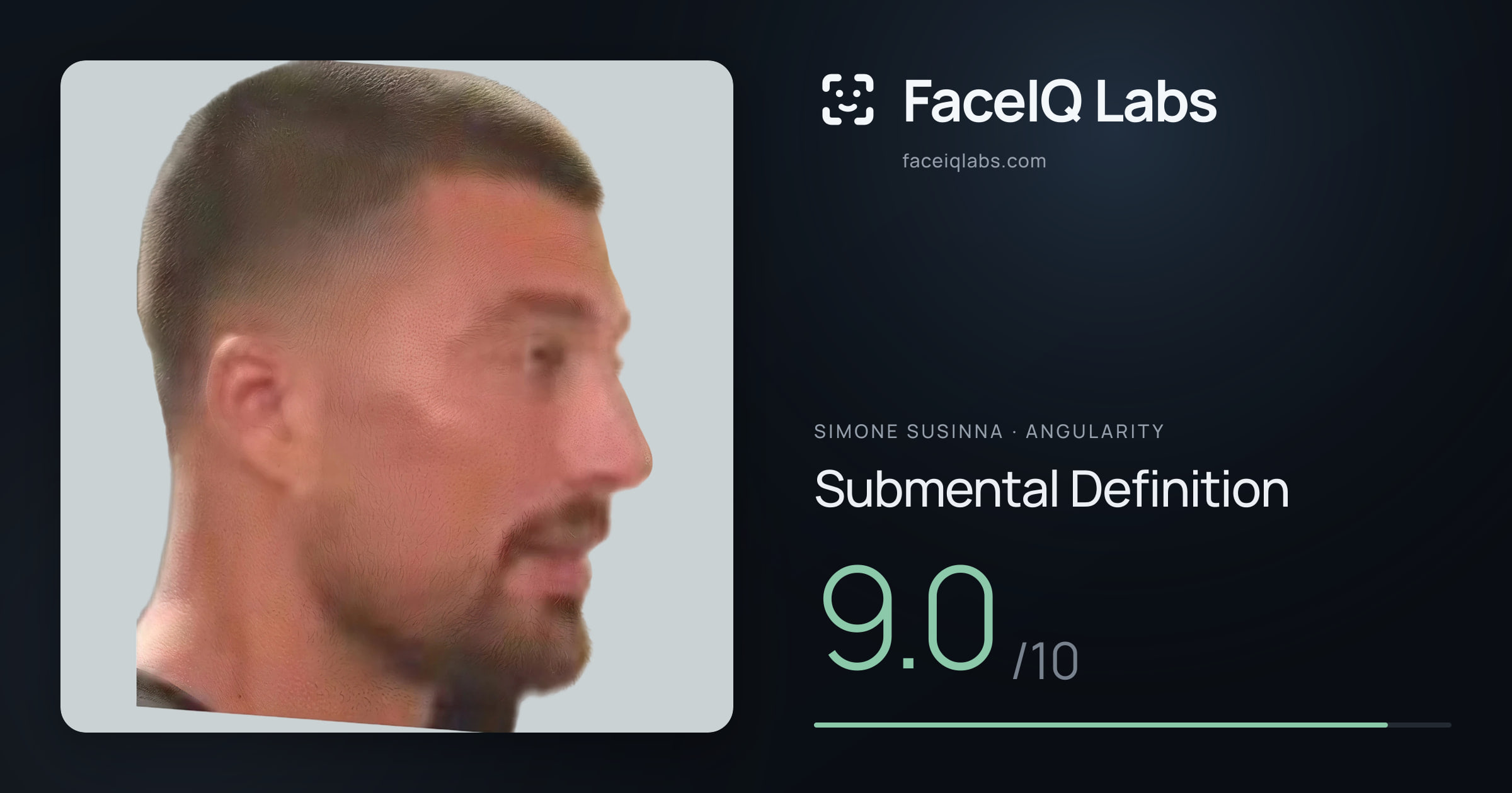 Simone Susinna Submental Definition: 9.0/10, drawn on the photo