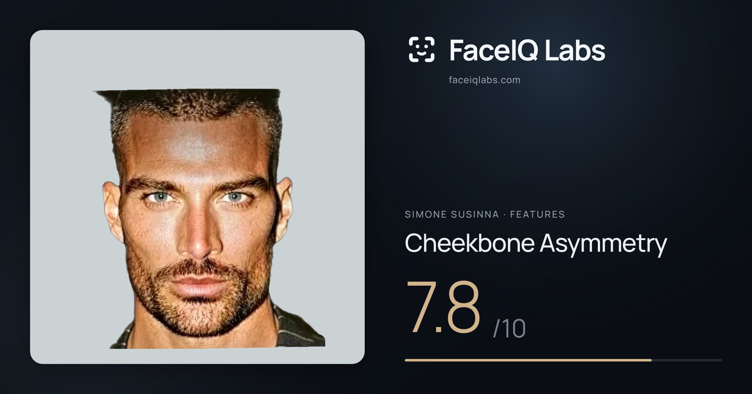 Simone Susinna Cheekbone Asymmetry: 7.8/10, drawn on the photo