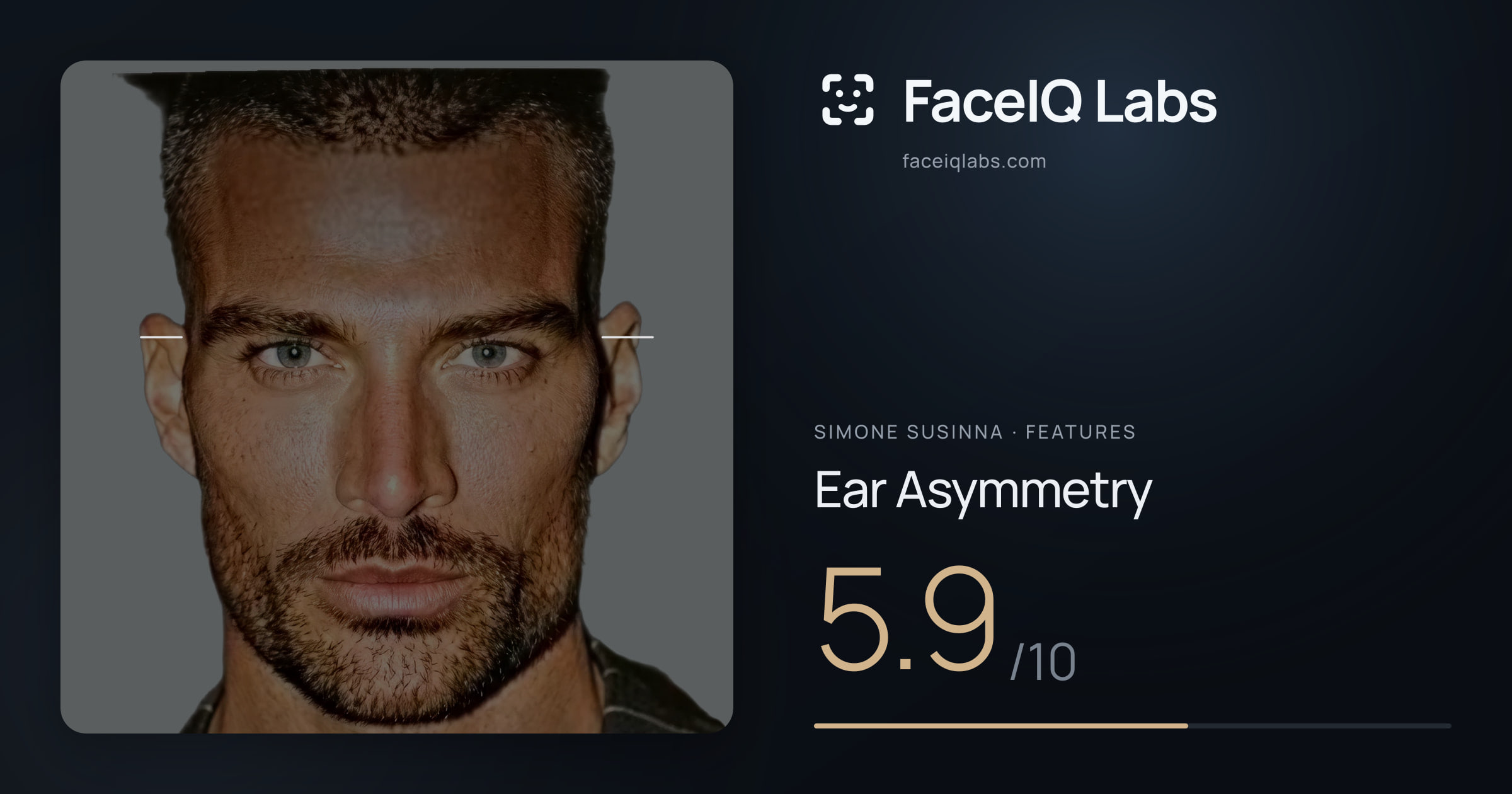 Simone Susinna Ear Asymmetry: 5.9/10, drawn on the photo