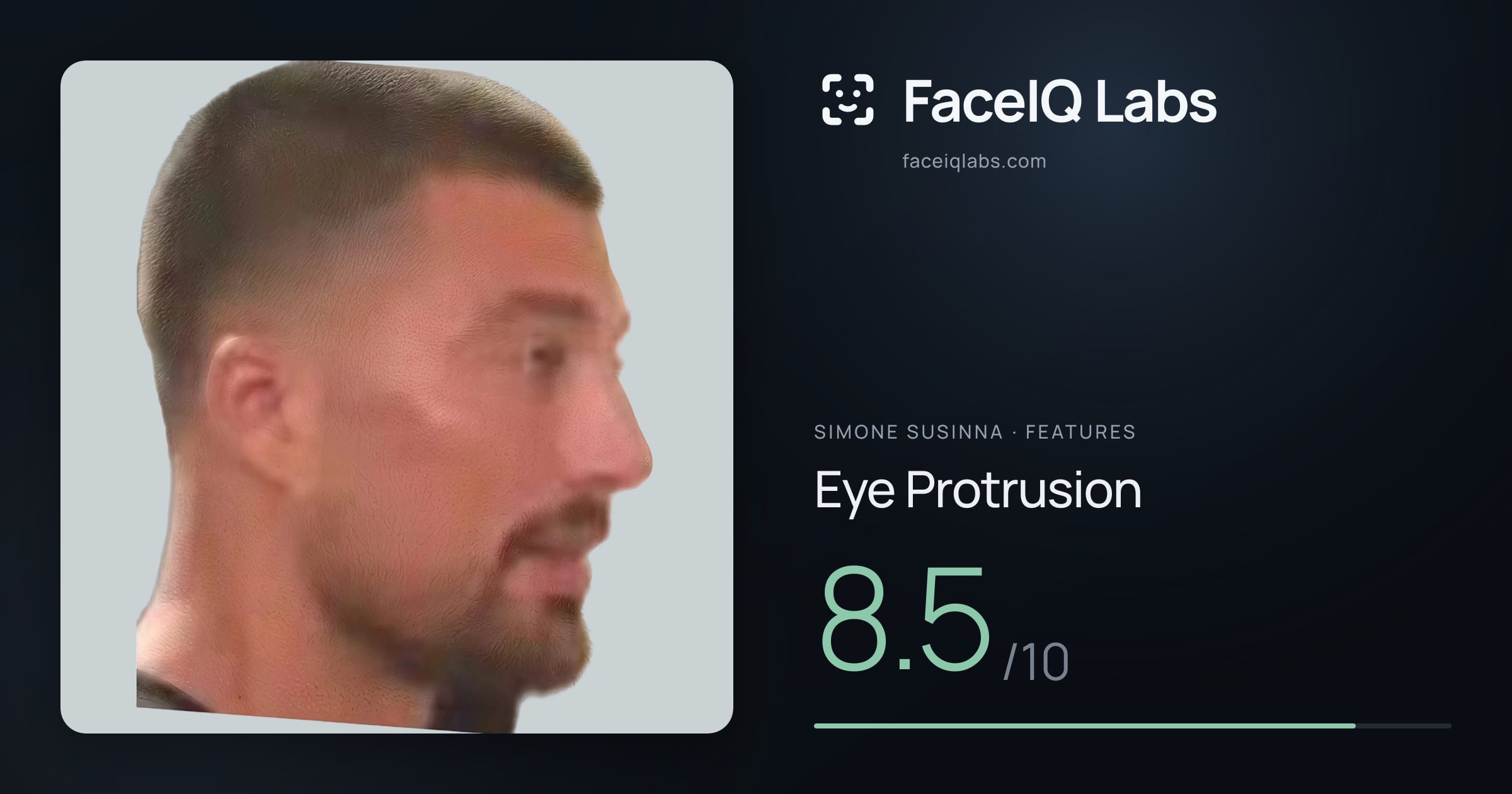 Simone Susinna Eye Protrusion: 8.5/10, drawn on the photo