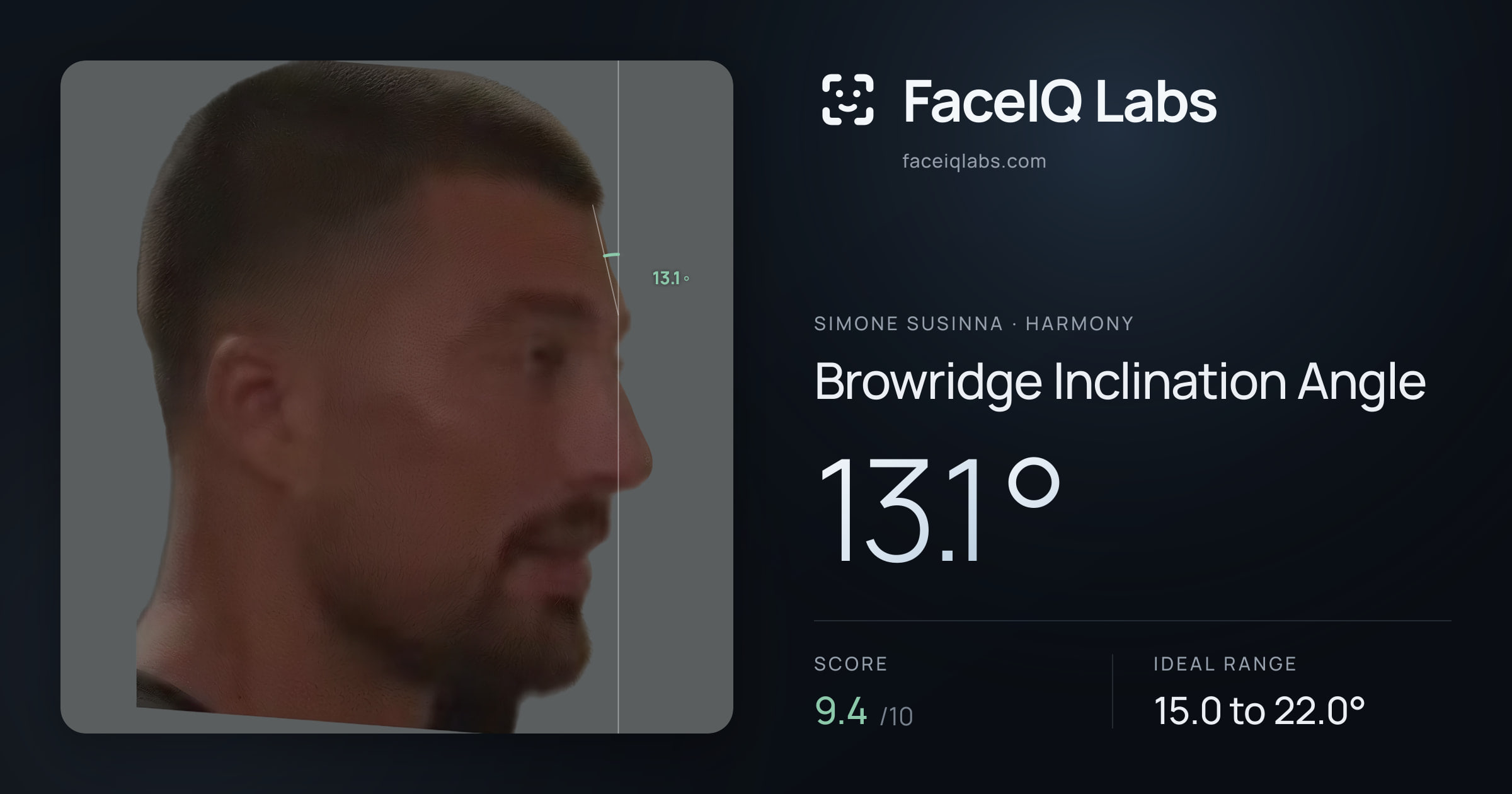 Simone Susinna Browridge Inclination Angle: 13.1°, drawn on the photo