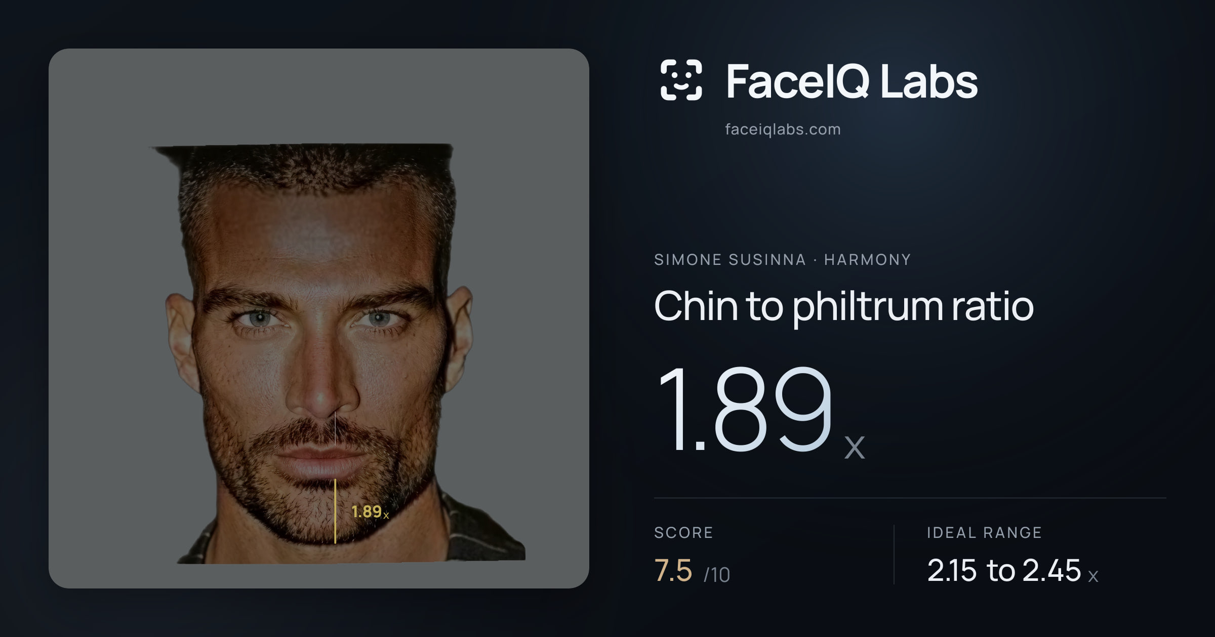Simone Susinna Chin to philtrum ratio: 1.89x, drawn on the photo