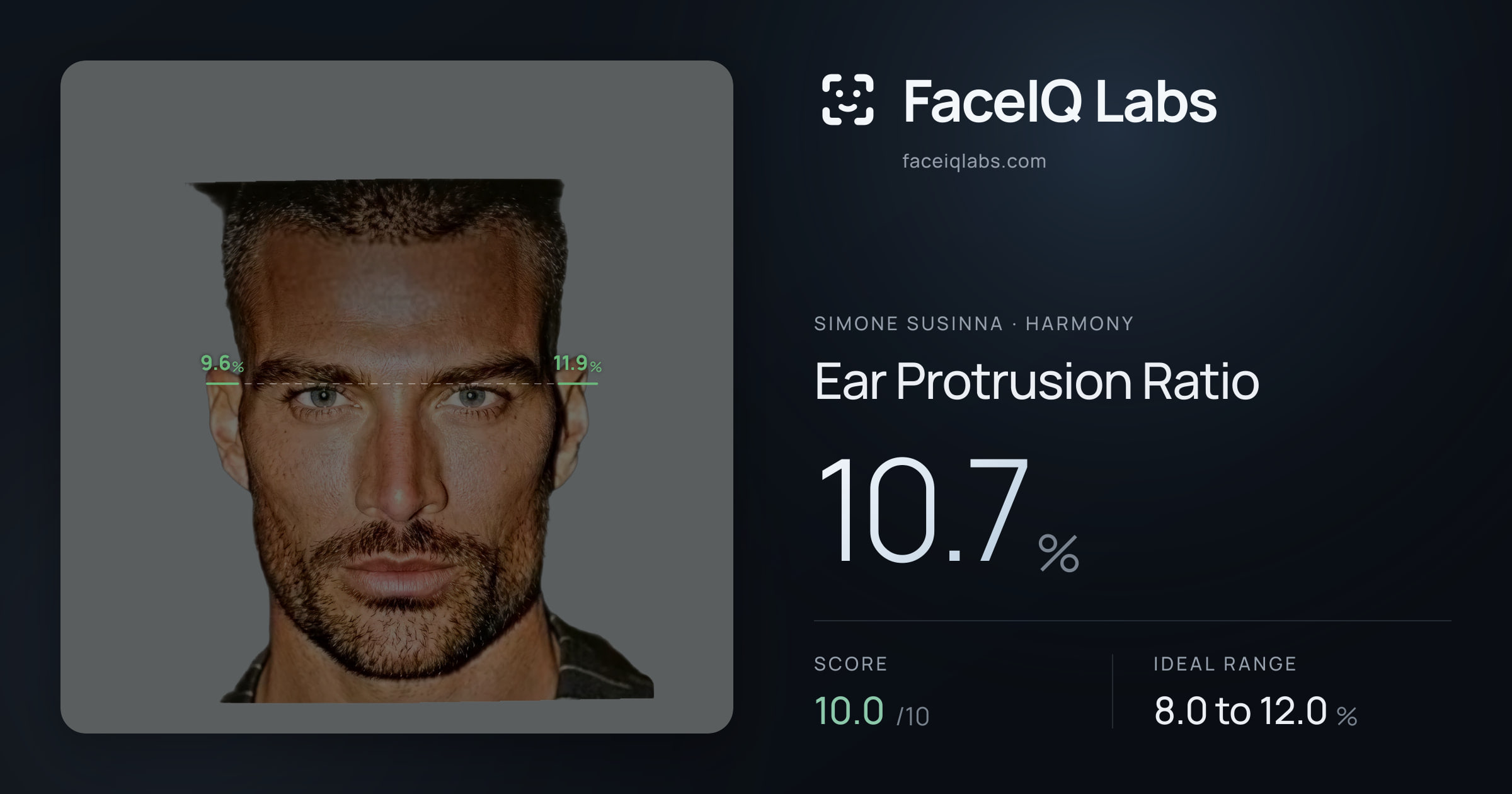 Simone Susinna Ear Protrusion Ratio: 10.7%, drawn on the photo