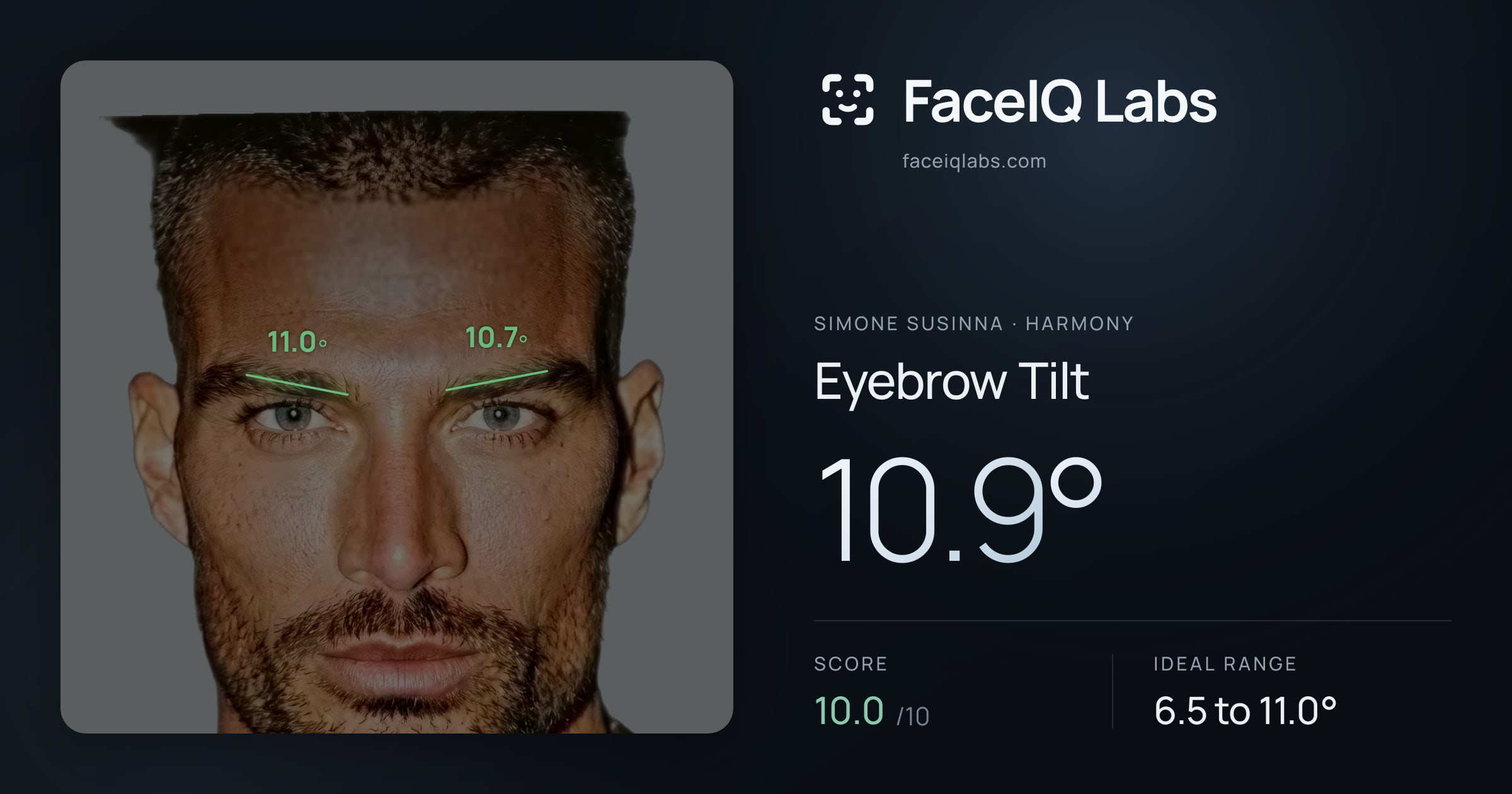 Simone Susinna Eyebrow Tilt: 10.9°, drawn on the photo