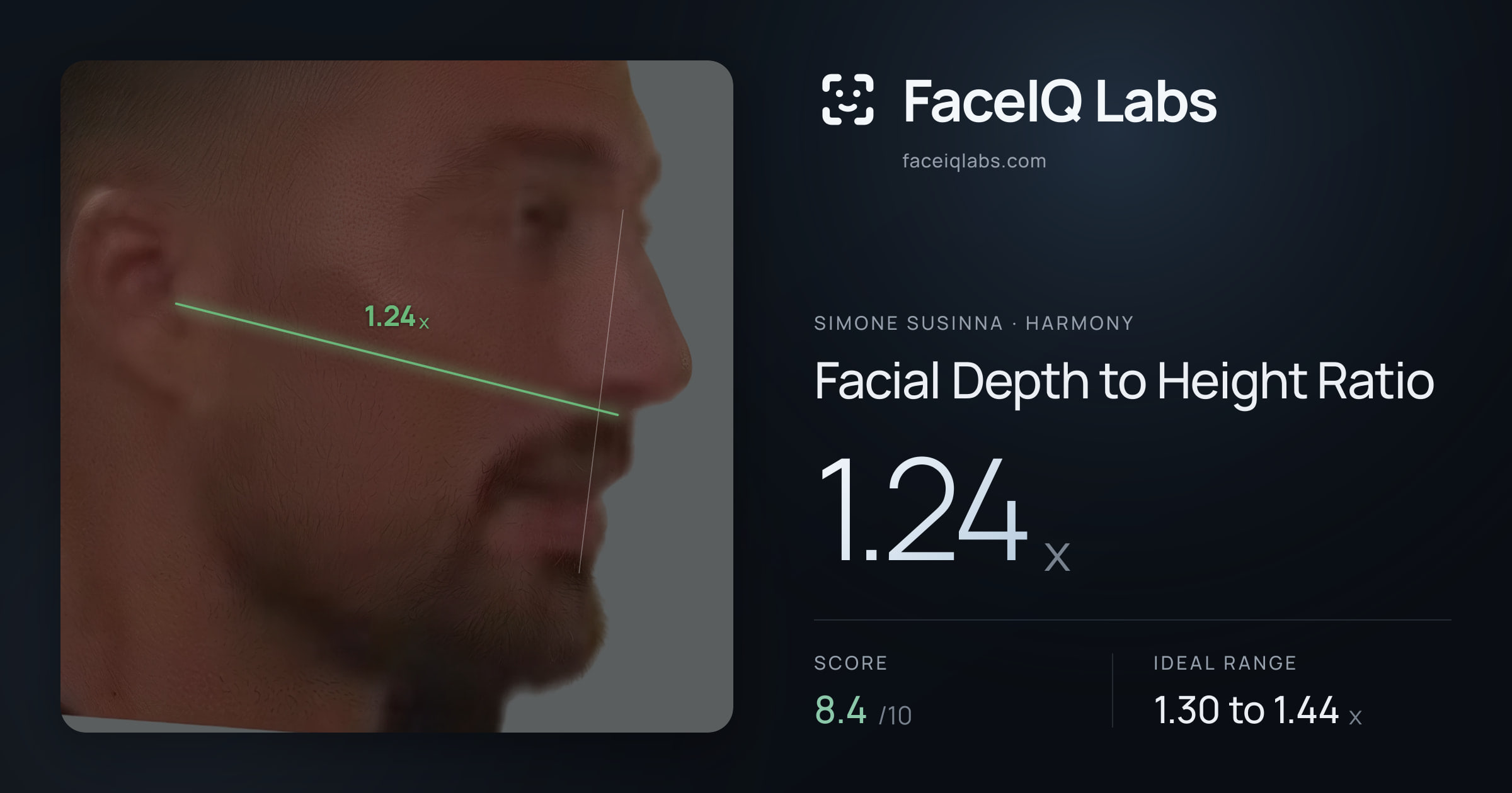 Simone Susinna Facial Depth to Height Ratio: 1.24x, drawn on the photo