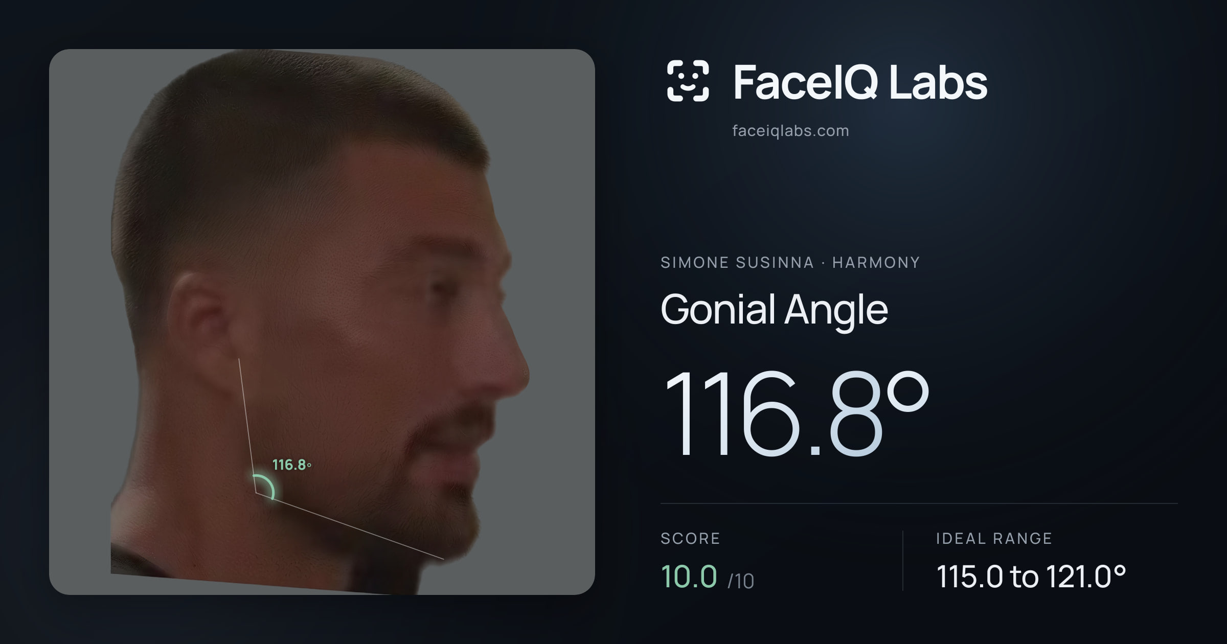Simone Susinna Gonial Angle: 116.8°, drawn on the photo