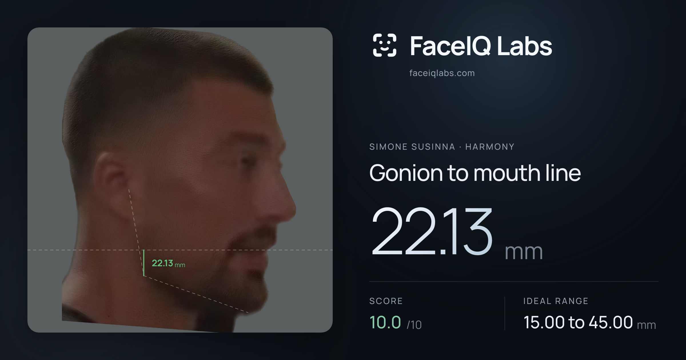 Simone Susinna Gonion to mouth line: 22.13mm, drawn on the photo