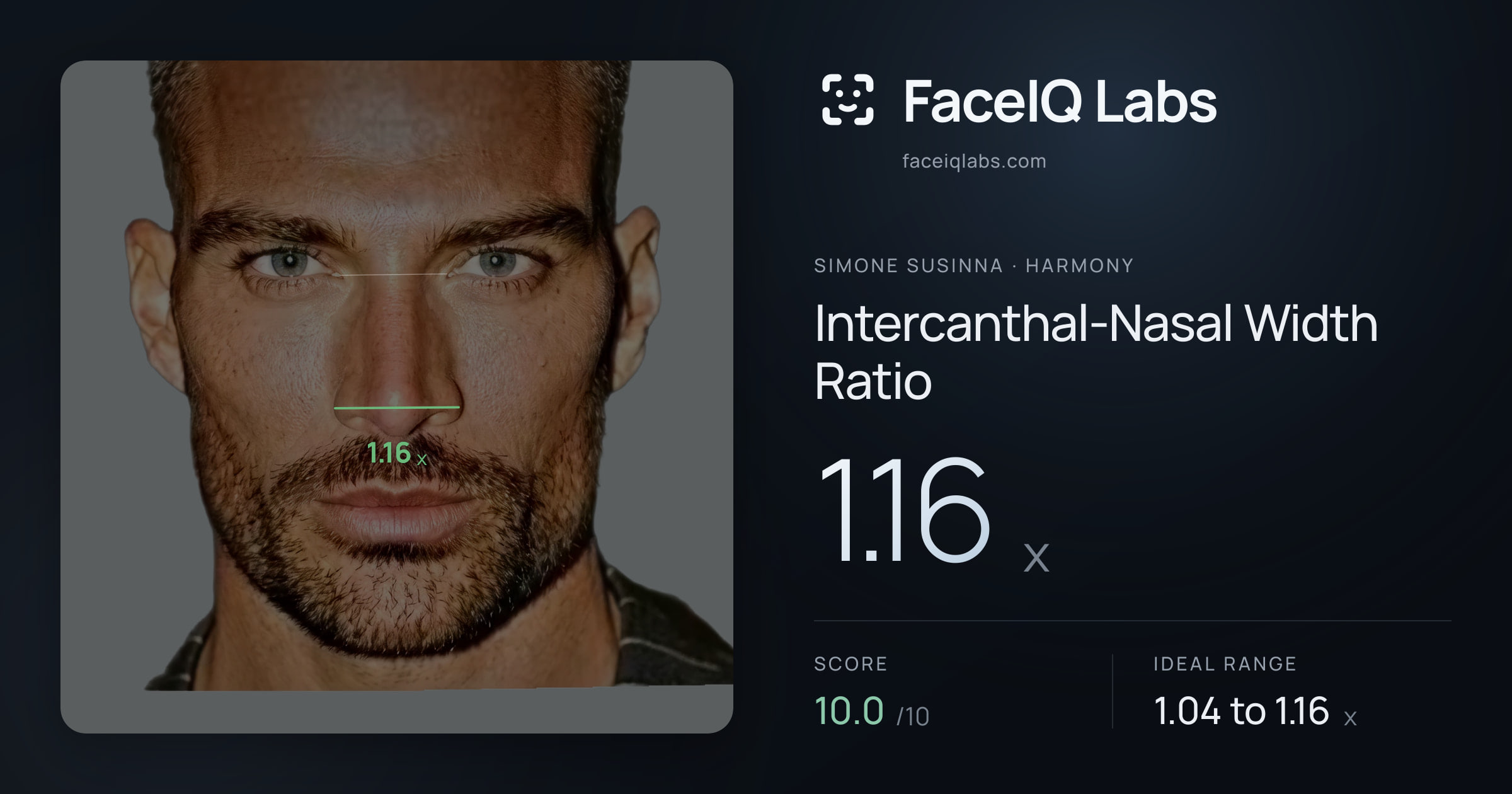 Simone Susinna Intercanthal-Nasal Width Ratio: 1.16x, drawn on the photo