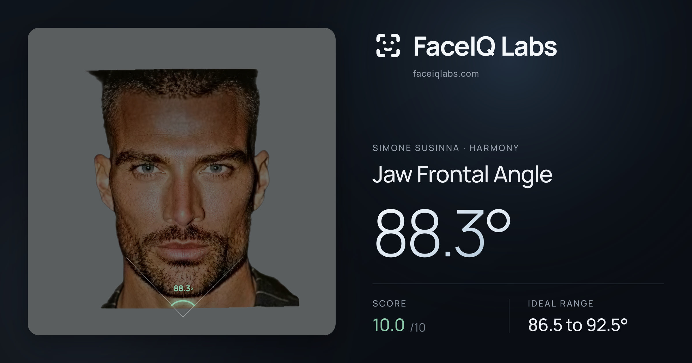 Simone Susinna Jaw Frontal Angle: 88.3°, drawn on the photo
