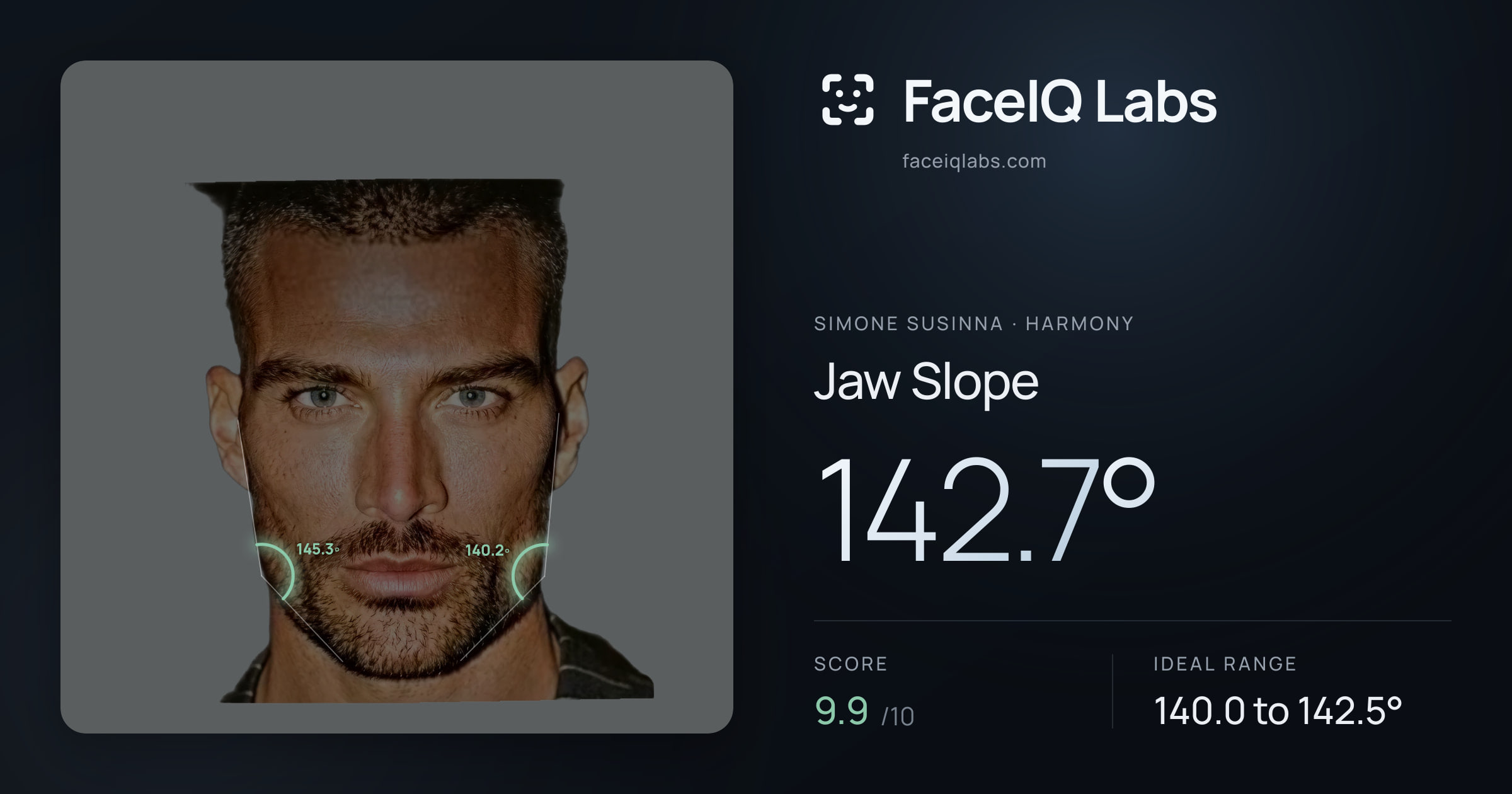 Simone Susinna Jaw Slope: 142.7°, drawn on the photo