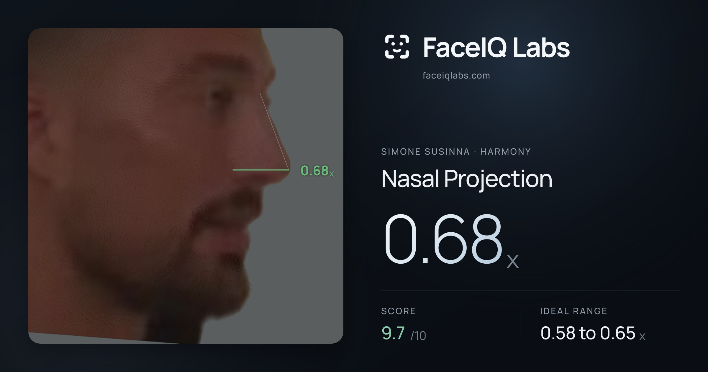 Simone Susinna Nasal Projection: 0.68x, drawn on the photo