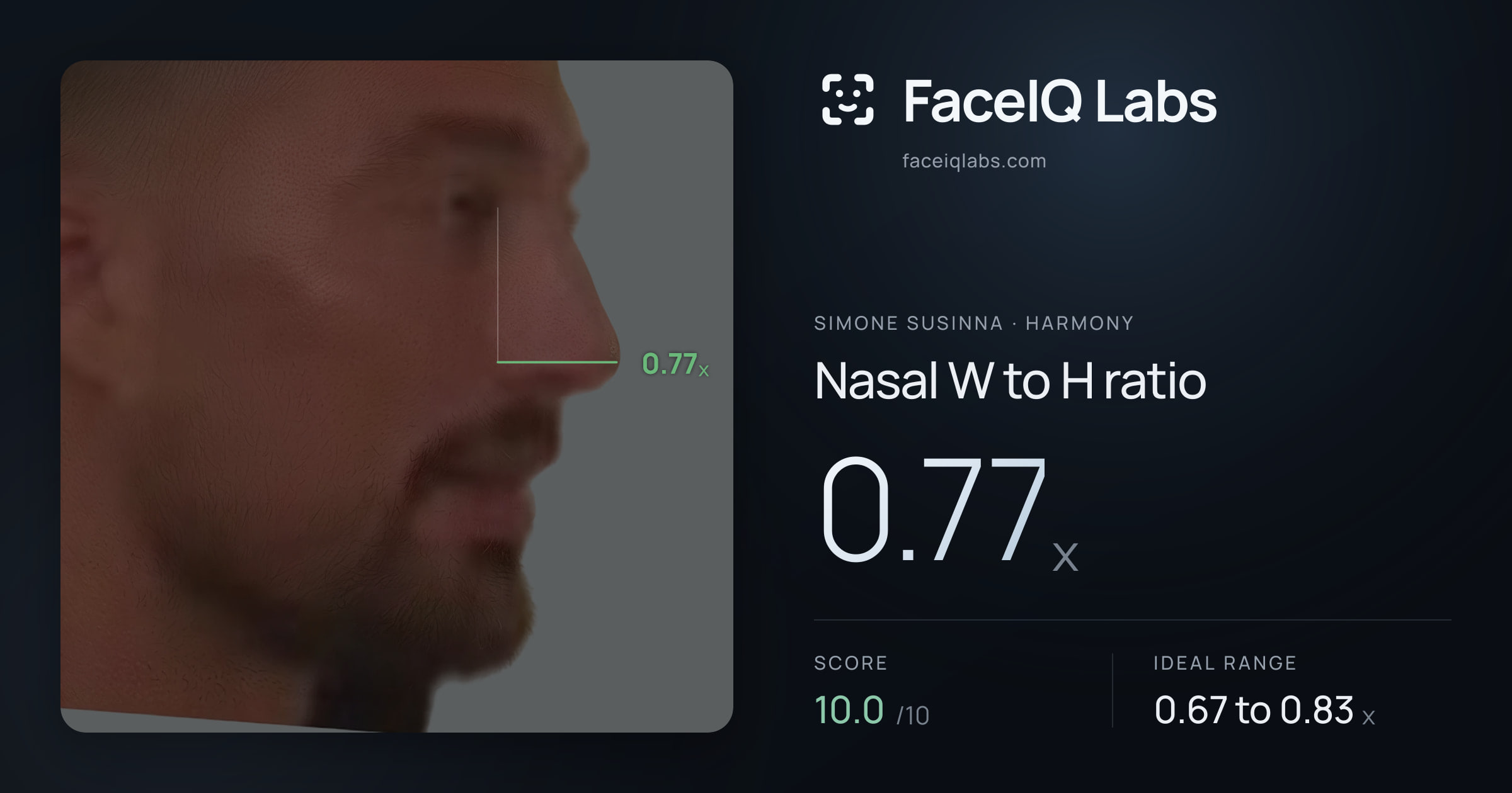 Simone Susinna Nasal W to H ratio: 0.77x, drawn on the photo