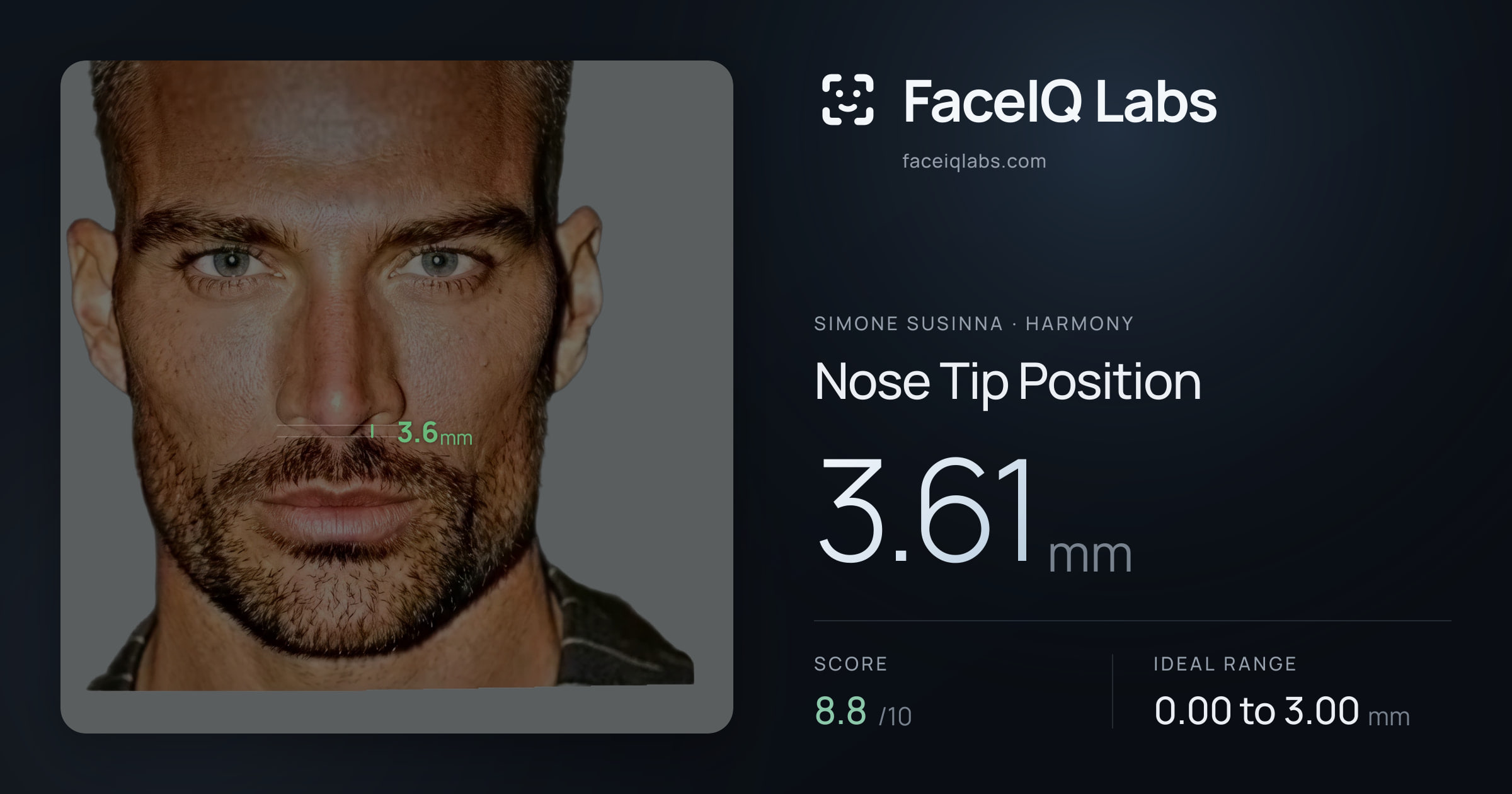 Simone Susinna Nose Tip Position: 3.61mm, drawn on the photo