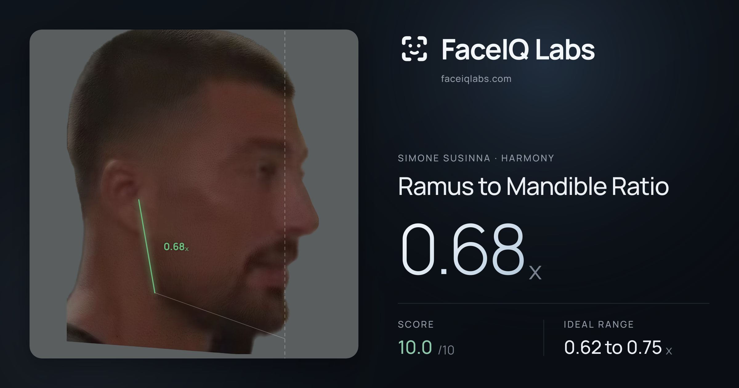 Simone Susinna Ramus to Mandible Ratio: 0.68x, drawn on the photo