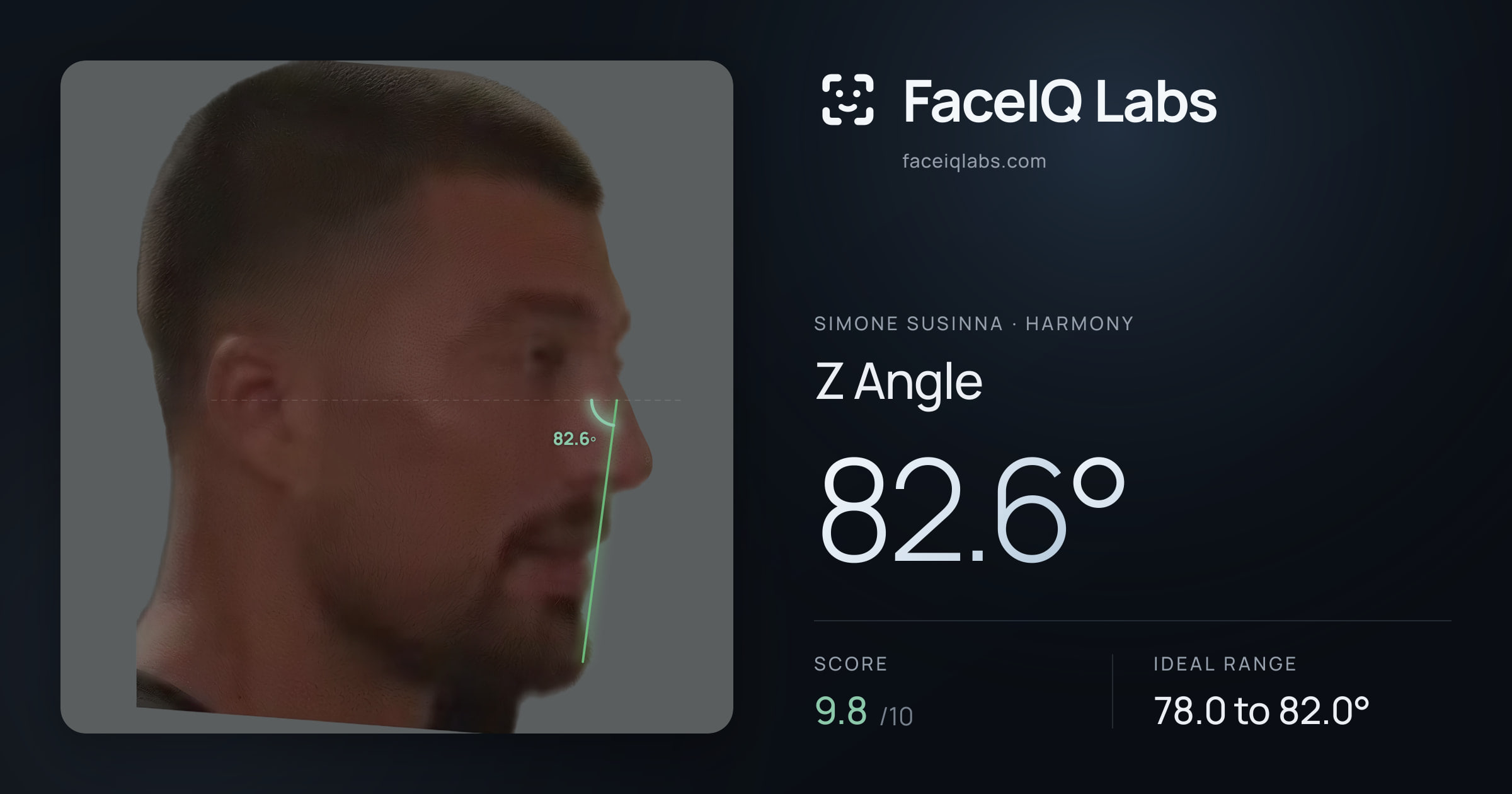 Simone Susinna Z Angle: 82.6°, drawn on the photo