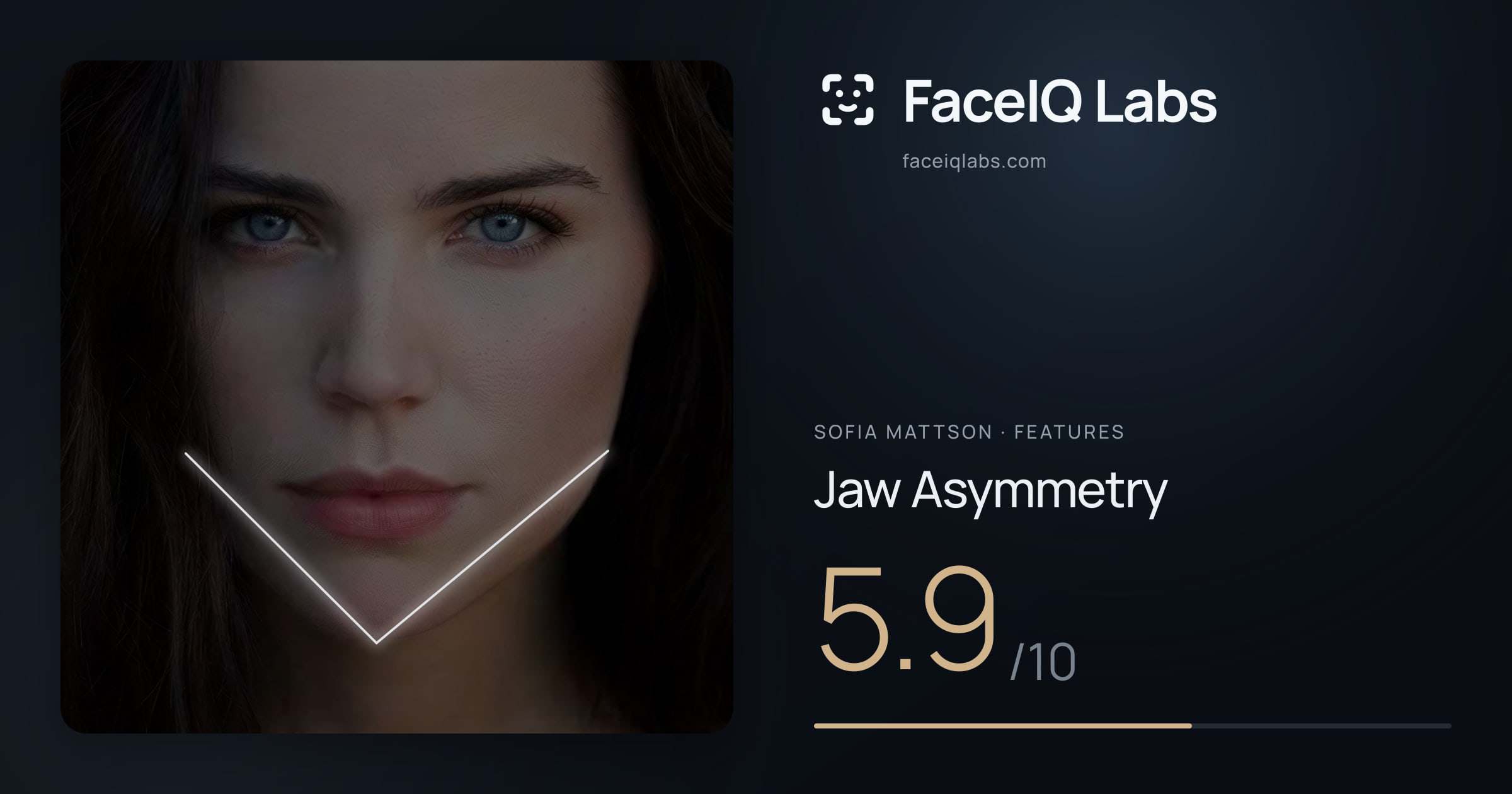 Sofia Mattson Jaw Asymmetry: 5.9/10, drawn on the photo