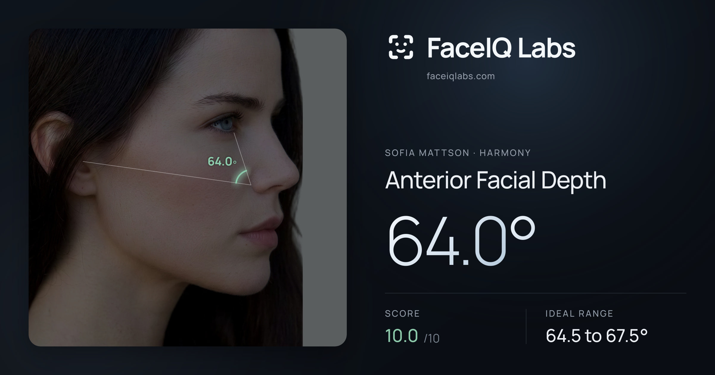 Sofia Mattson Anterior Facial Depth: 64.0°, drawn on the photo