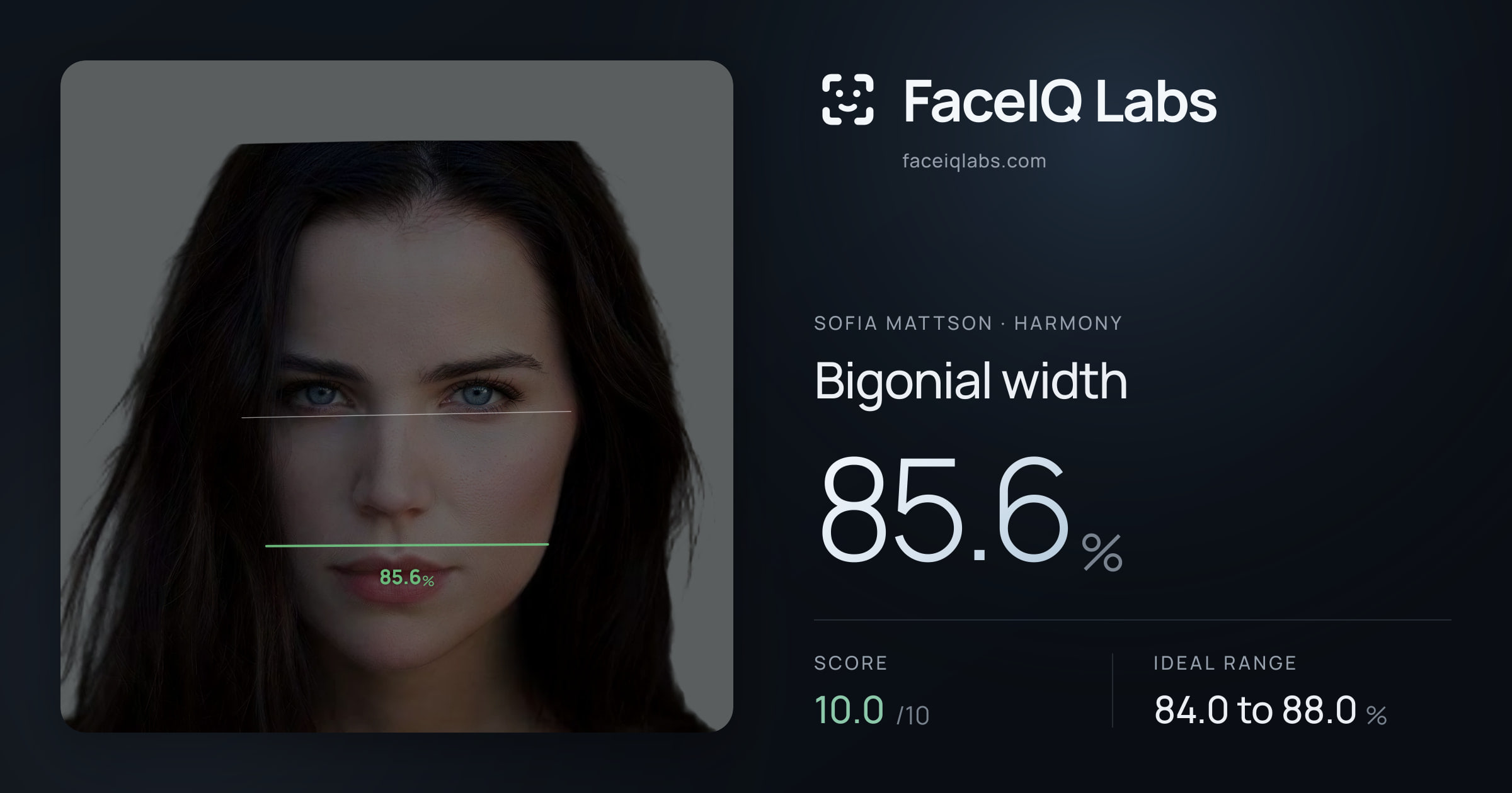 Sofia Mattson Bigonial width: 85.6%, drawn on the photo