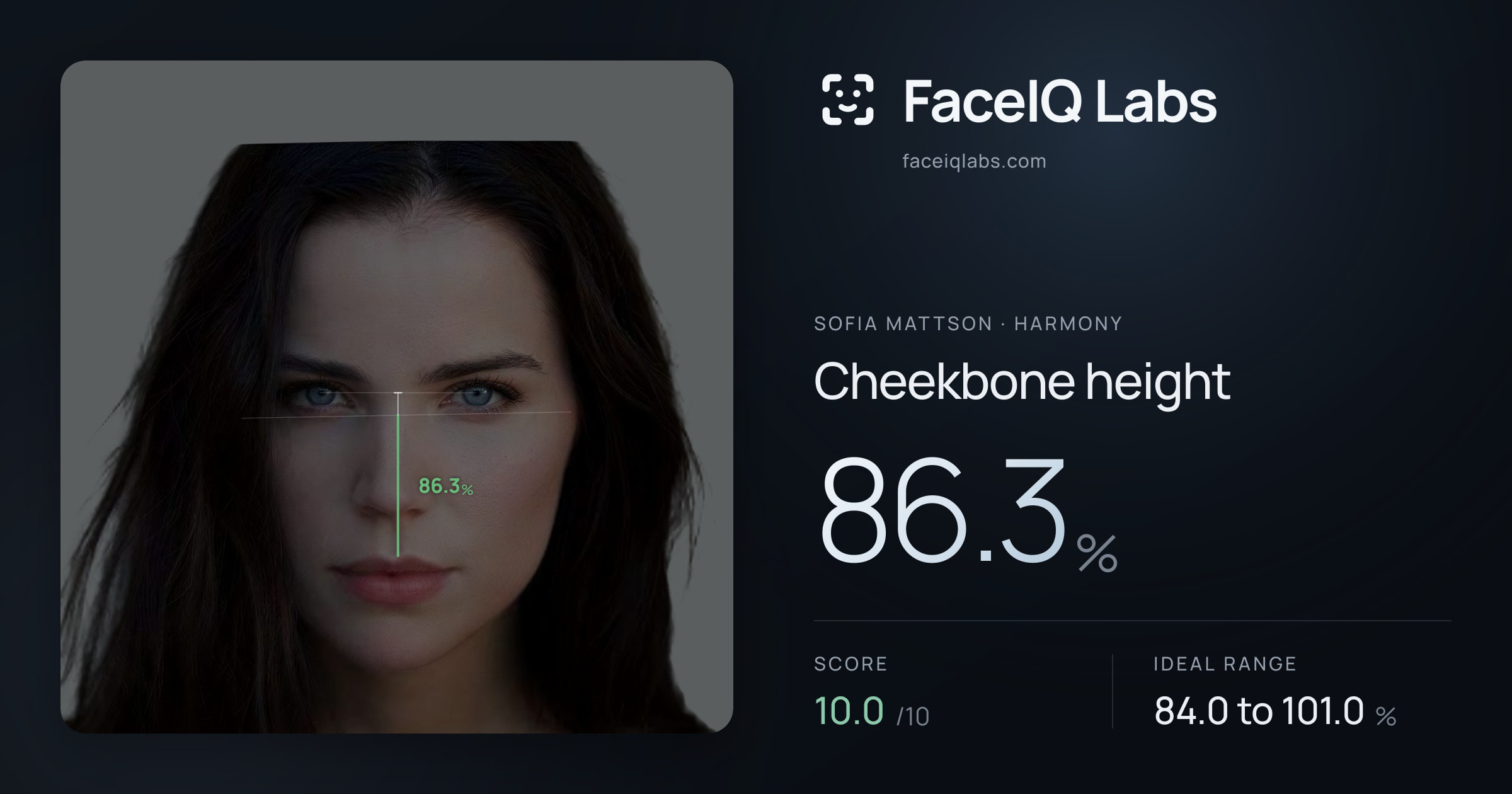Sofia Mattson Cheekbone height: 86.3%, drawn on the photo