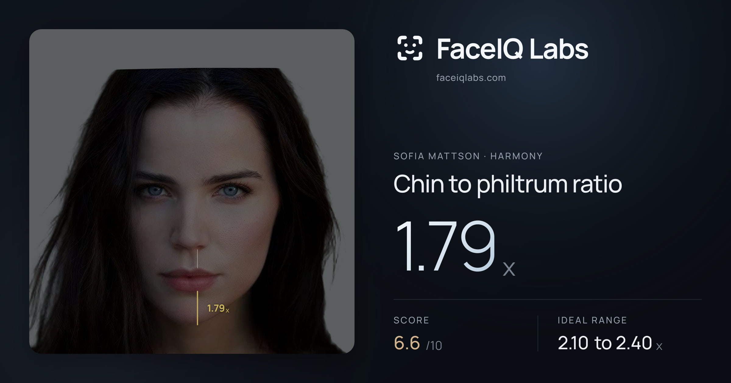 Sofia Mattson Chin to philtrum ratio: 1.79x, drawn on the photo