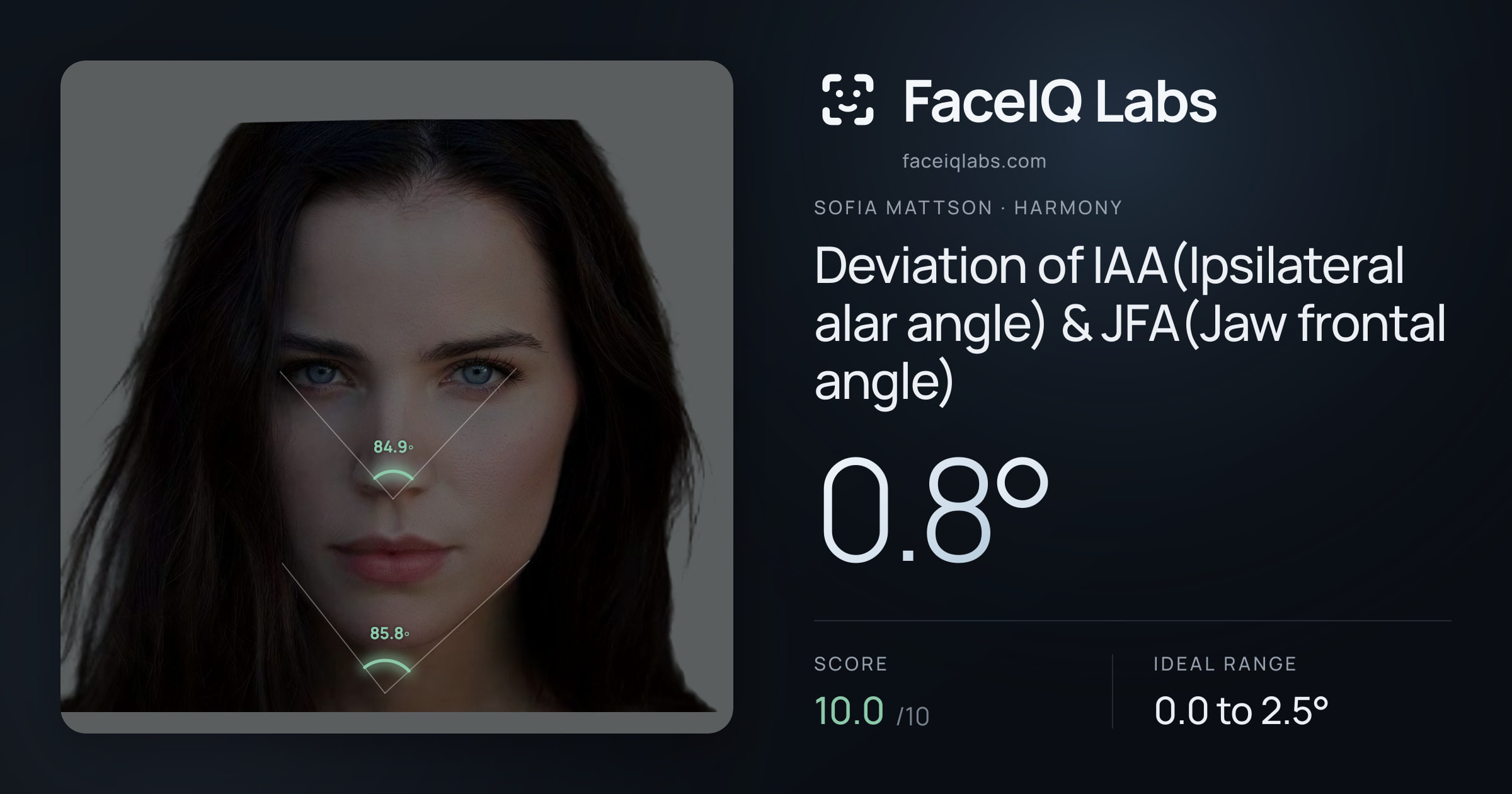 Sofia Mattson Deviation of IAA(Ipsilateral alar angle) & JFA(Jaw frontal angle): 0.8°, drawn on the photo
