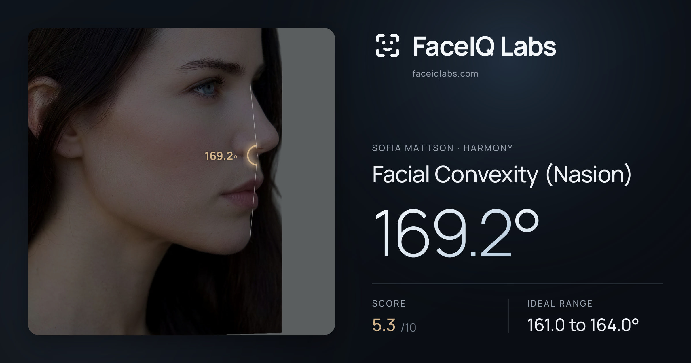 Sofia Mattson Facial Convexity (Nasion): 169.2°, drawn on the photo
