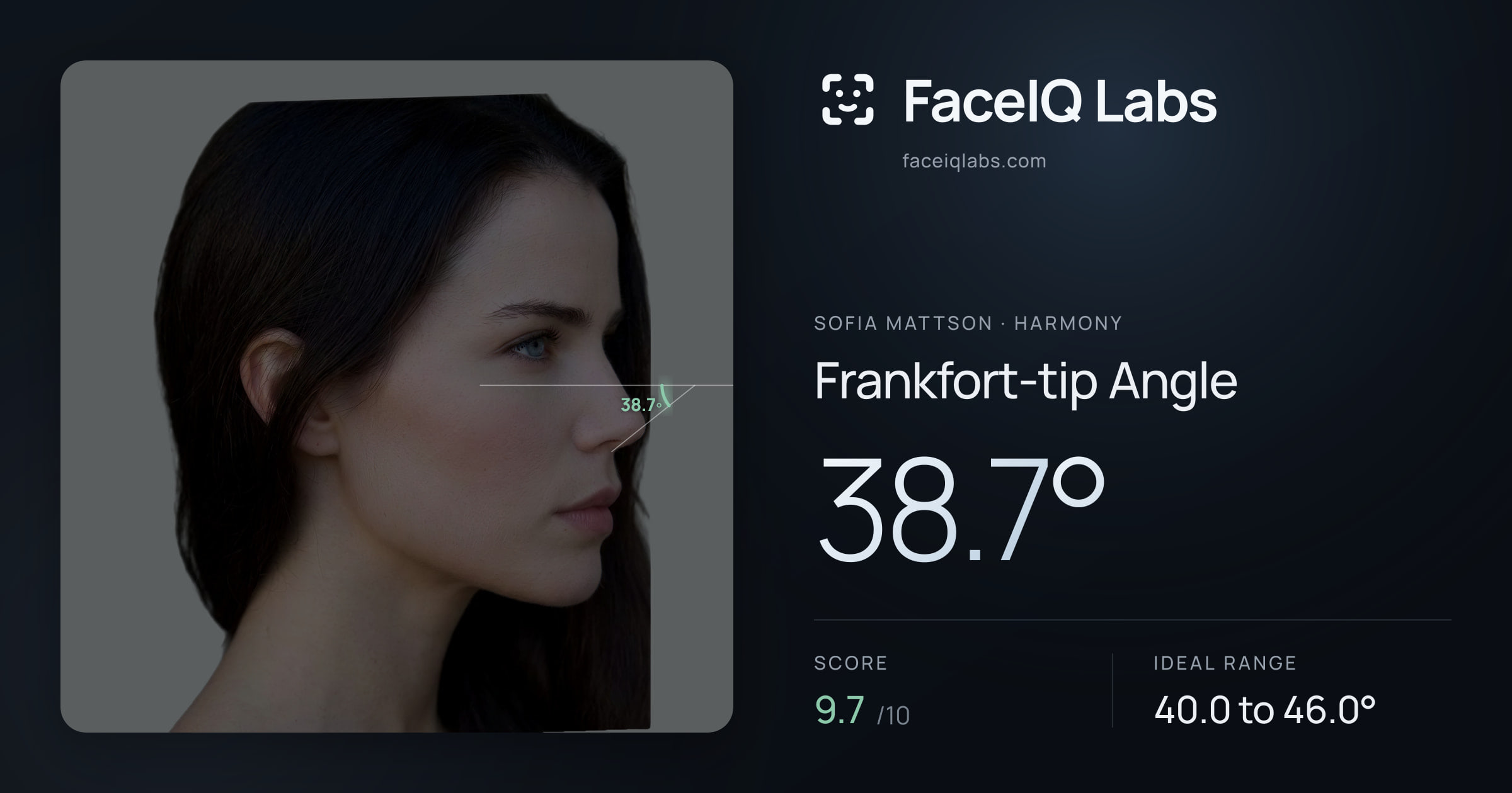 Sofia Mattson Frankfort-tip Angle: 38.7°, drawn on the photo