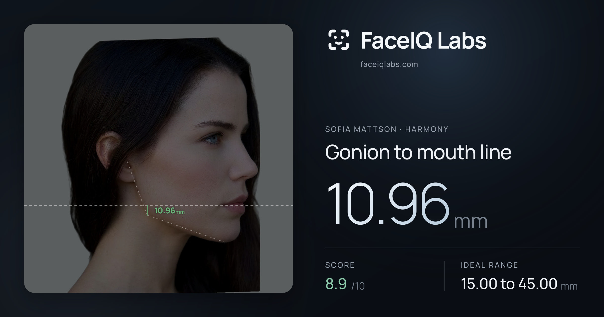 Sofia Mattson Gonion to mouth line: 10.96mm, drawn on the photo